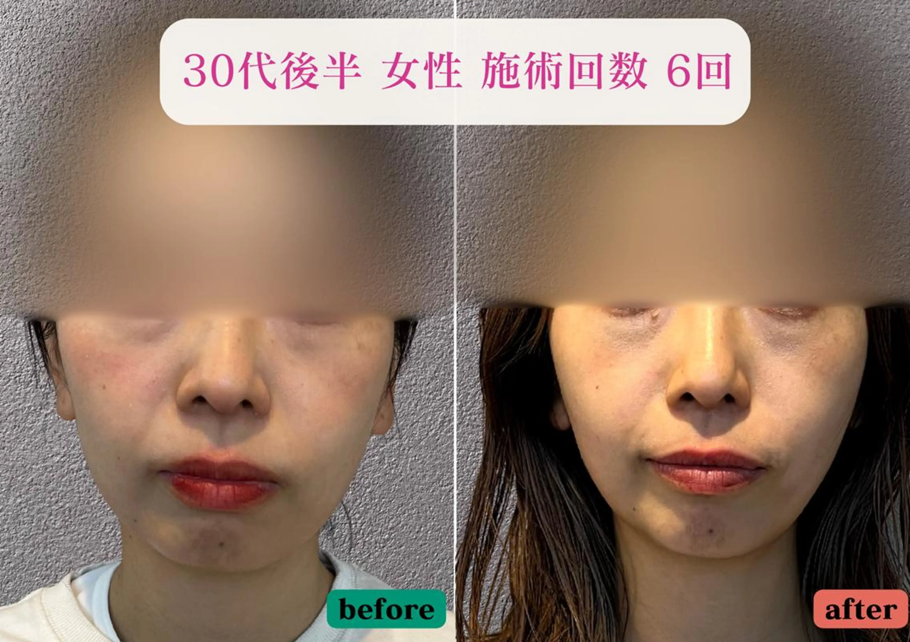 美容とカラダの鍼灸 サロン やなけんのエステ・リラクイメージ