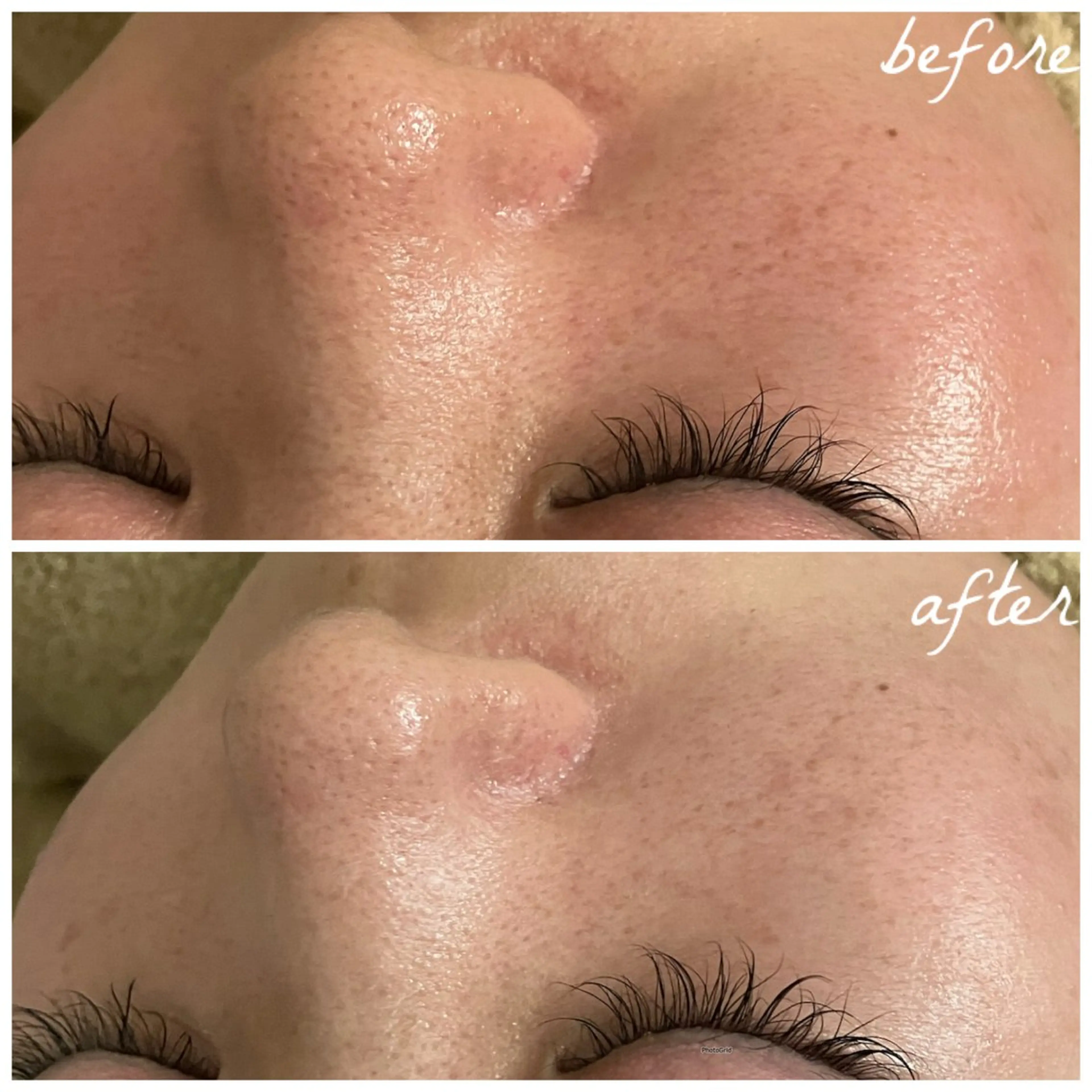 メンズ エステ メナード岐阜茜部 杉浦のエステ・リラクイメージ