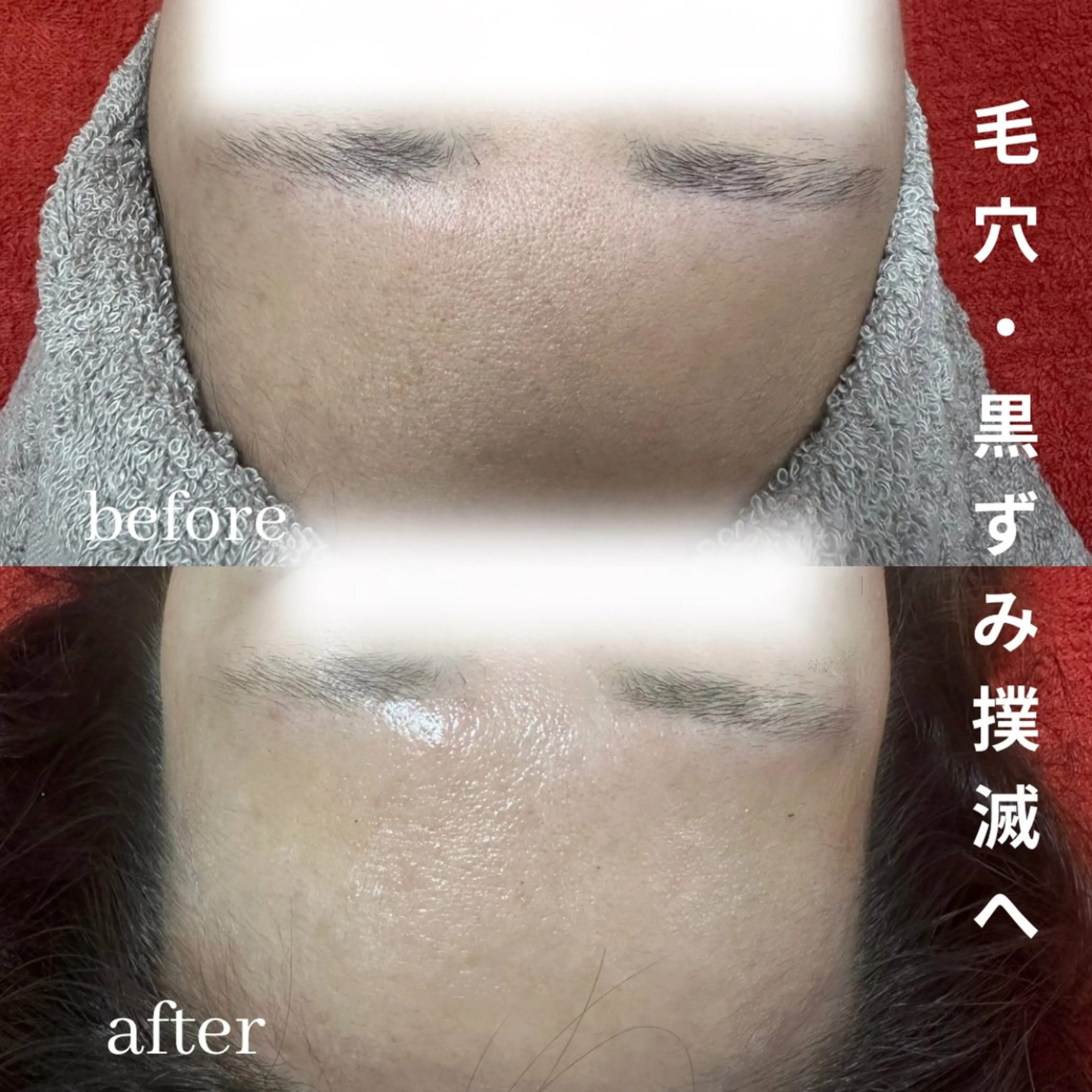 エステ ニキビ毛穴専門店Beautysalon Luana所属・小林 まいのエステ・リラクイメージ