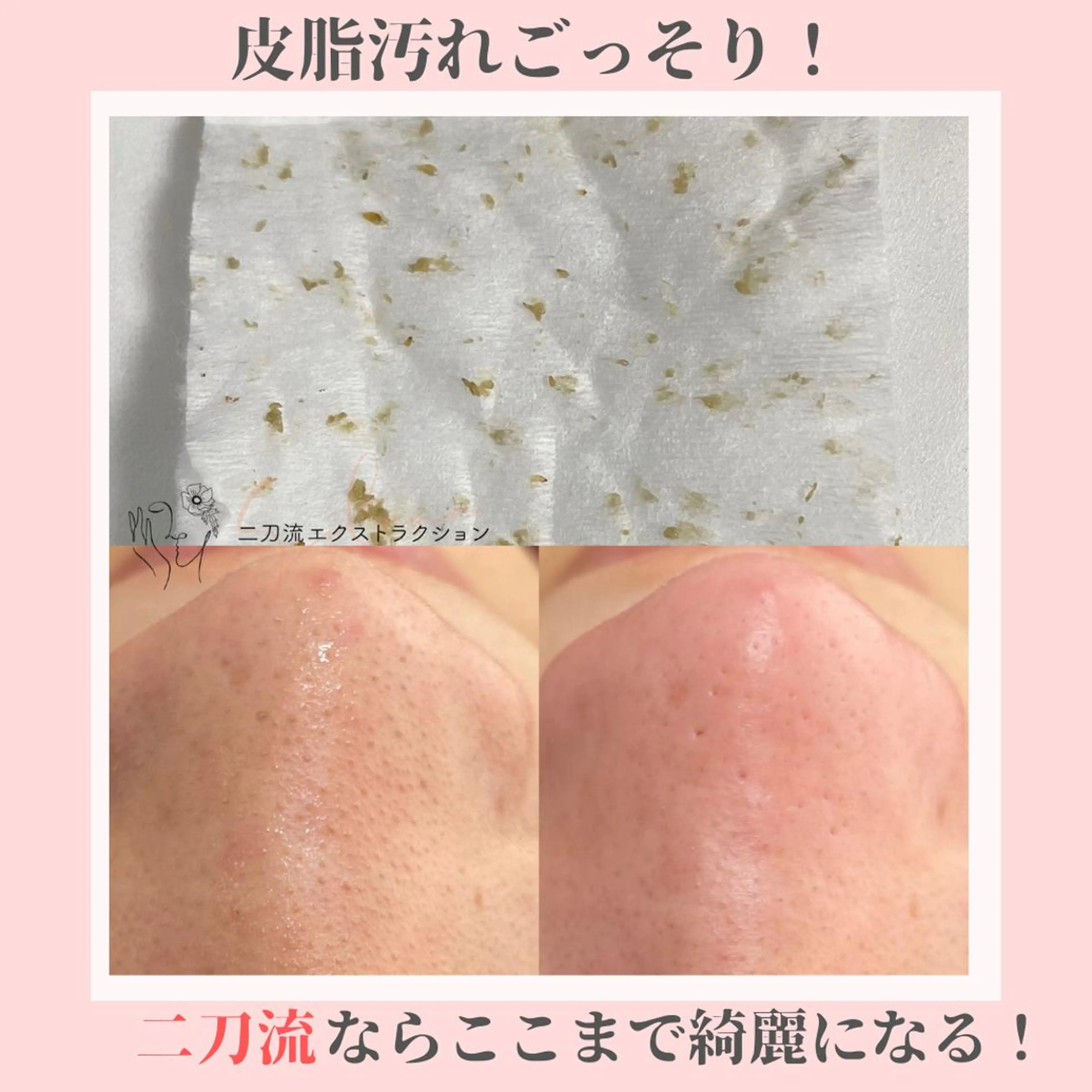 ピーリング専門店 Belluteのエステ・リラクイメージ