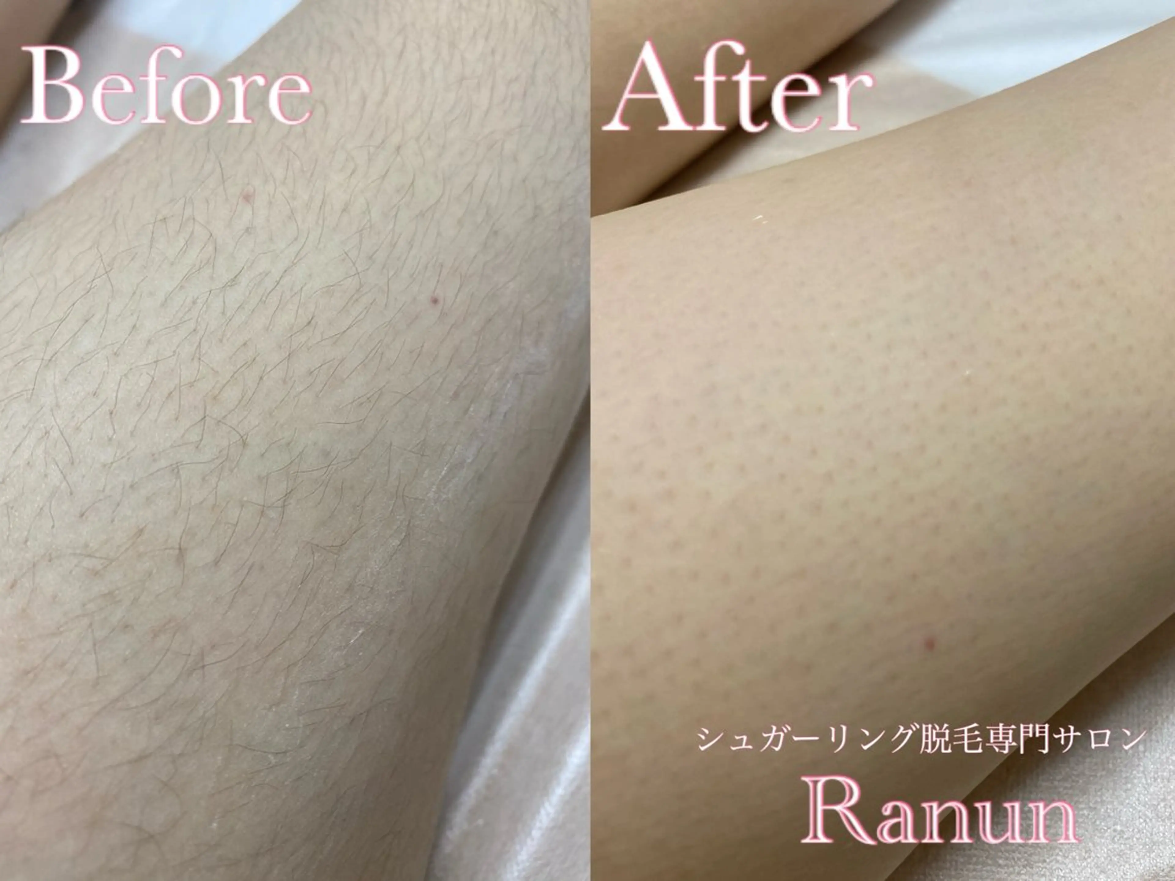 マツエク・マツパ シュガーリング脱毛 専門店Ranunのエステ・リラクイメージ