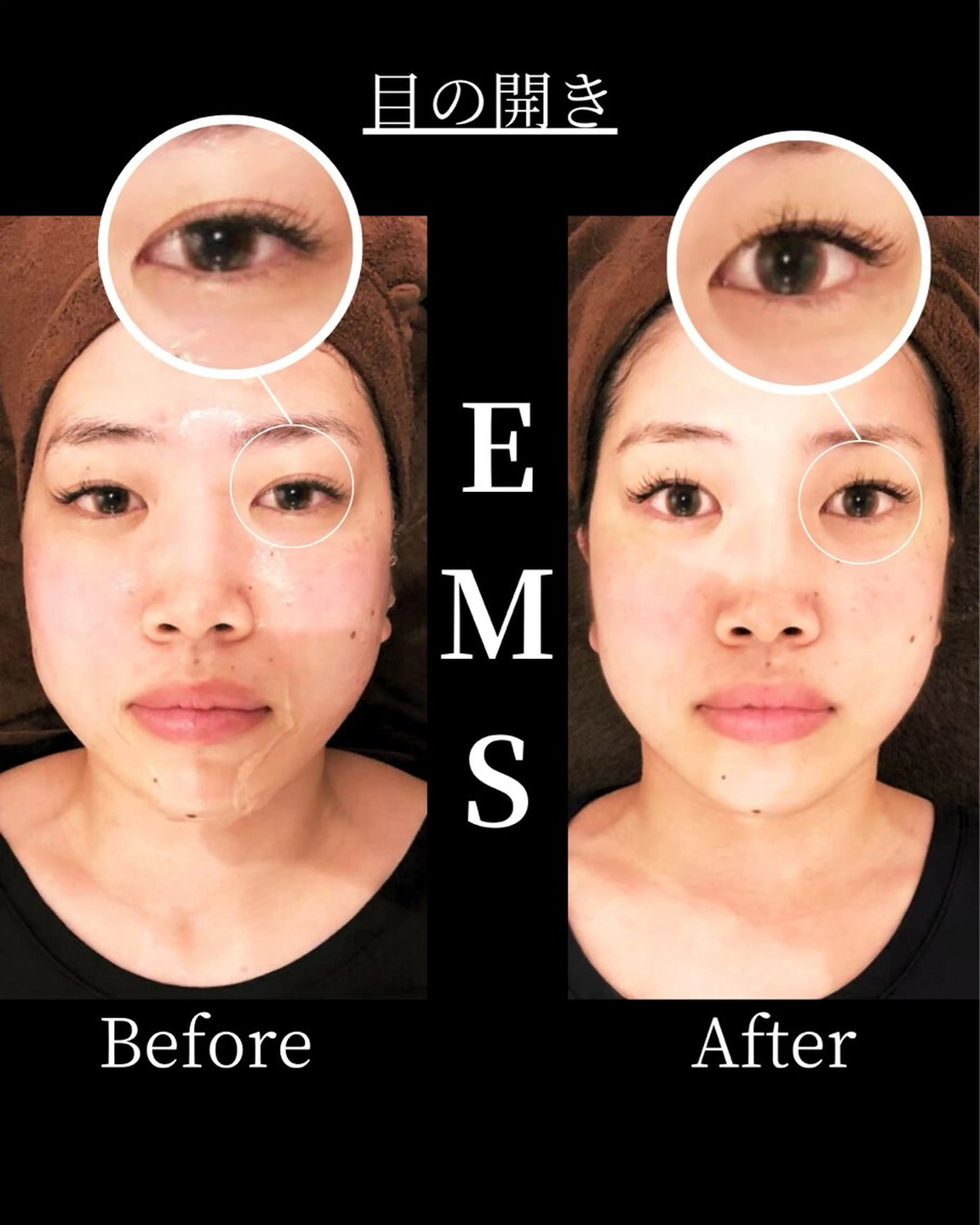 エステ リラク 恵比寿/小顔/矯正 美容整体師⭐︎Aiのエステ・リラクイメージ