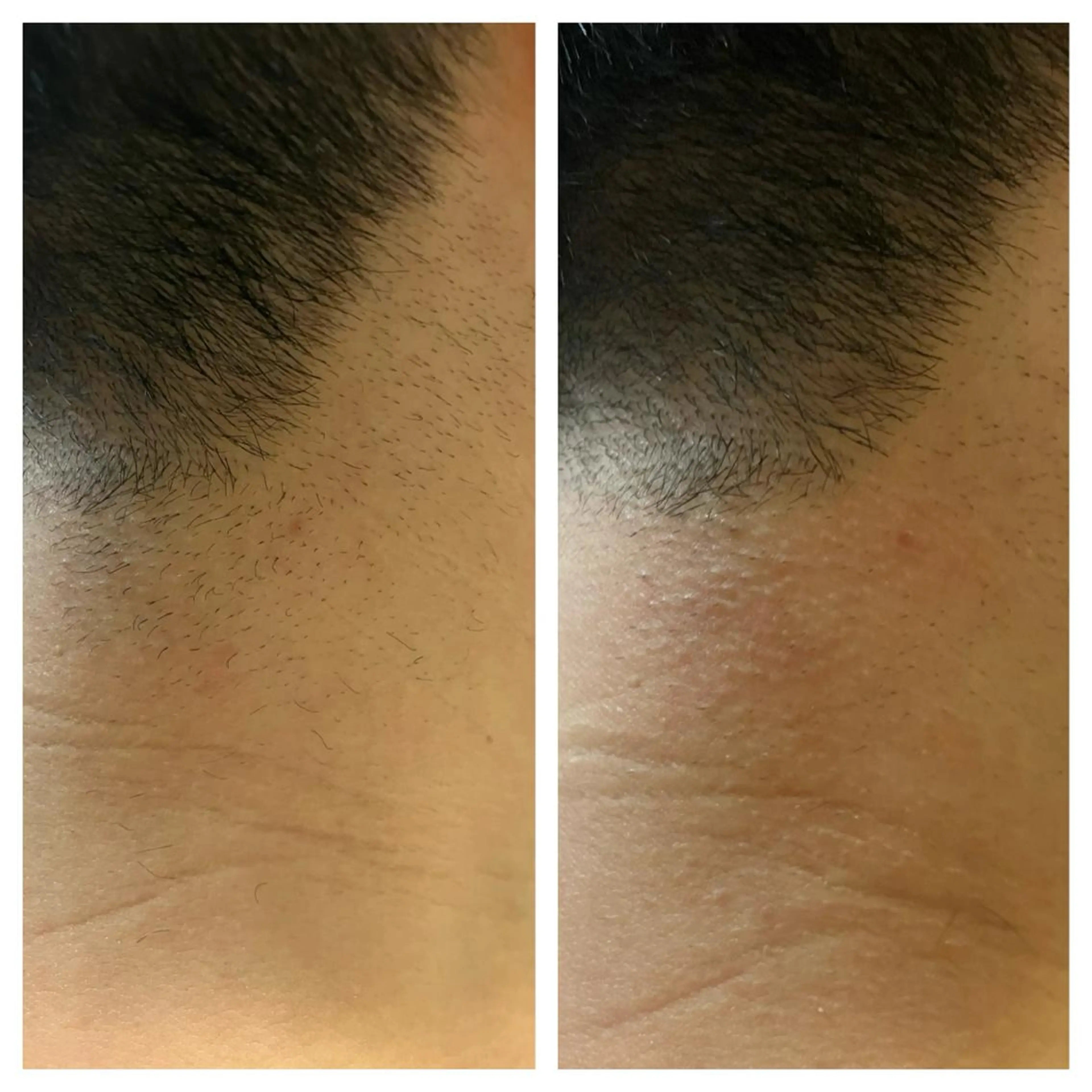 メンズ MISEREL岡崎店 Ayaのエステ・リラクイメージ