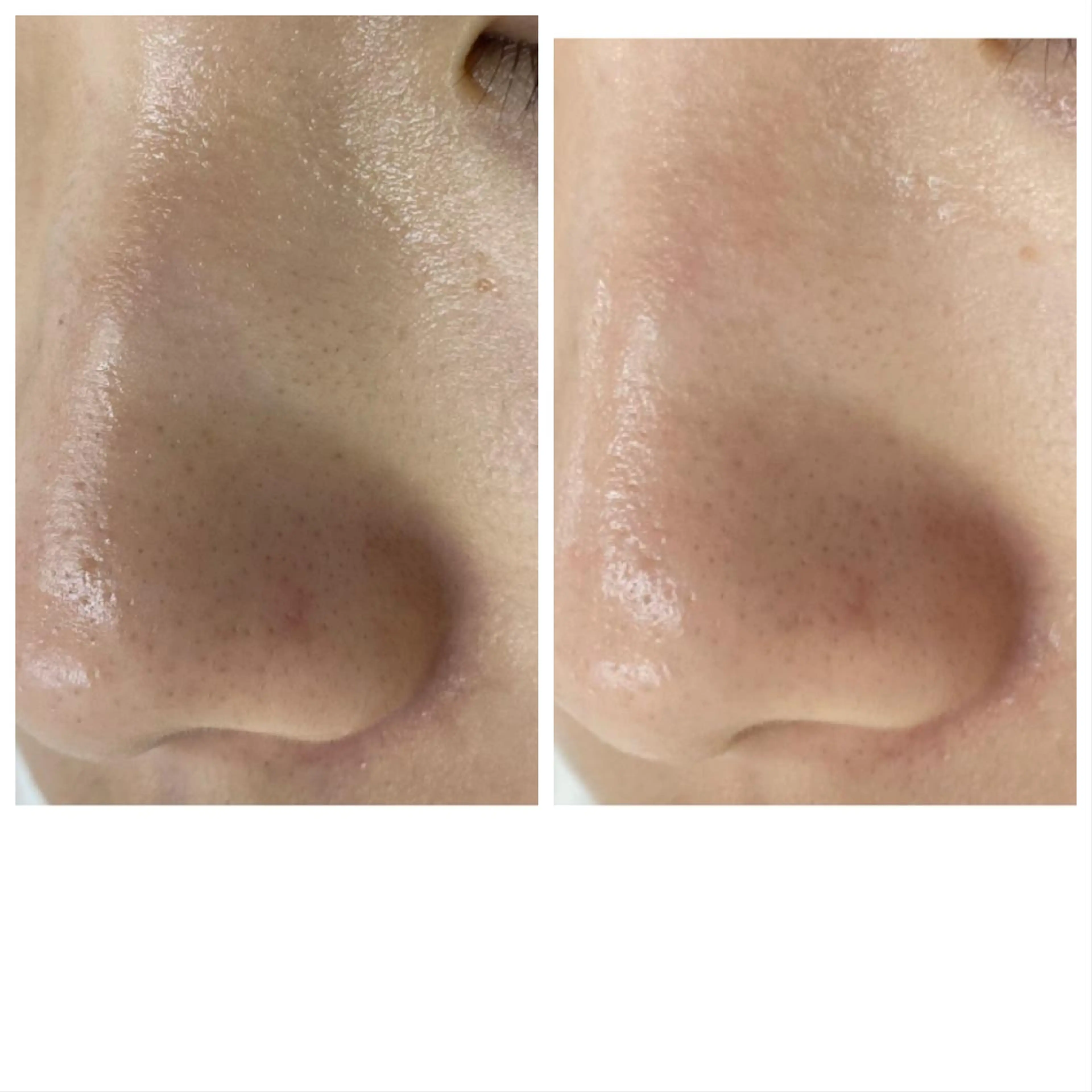 【毛穴・ハリ】お悩み別の肌質改善&メイクで至福の90分。初回のみ120分。通常¥7700→¥4500ミニモ特別価格です。の写真