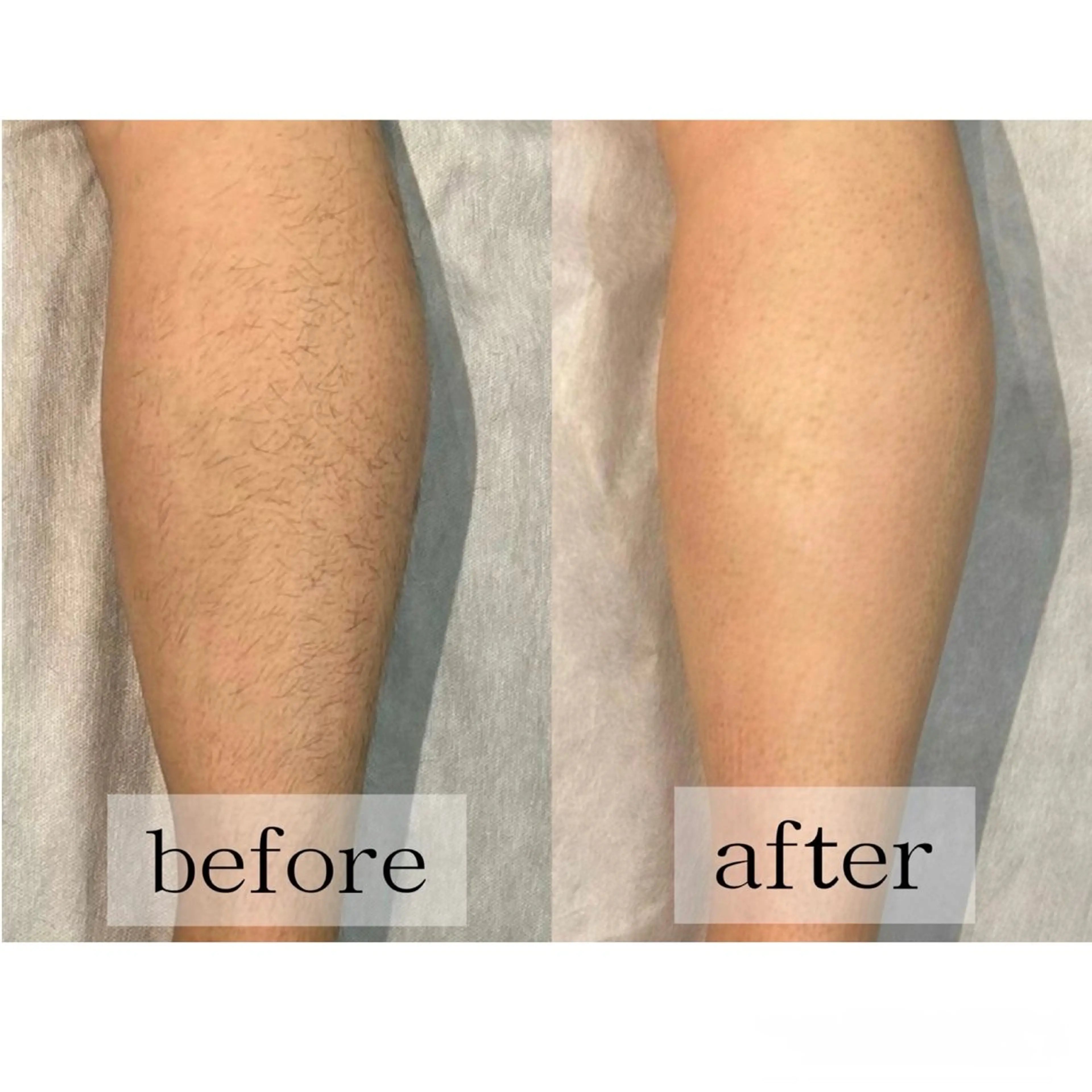 毛穴、肌質ケア専門 グランビューティのエステ・リラクイメージ