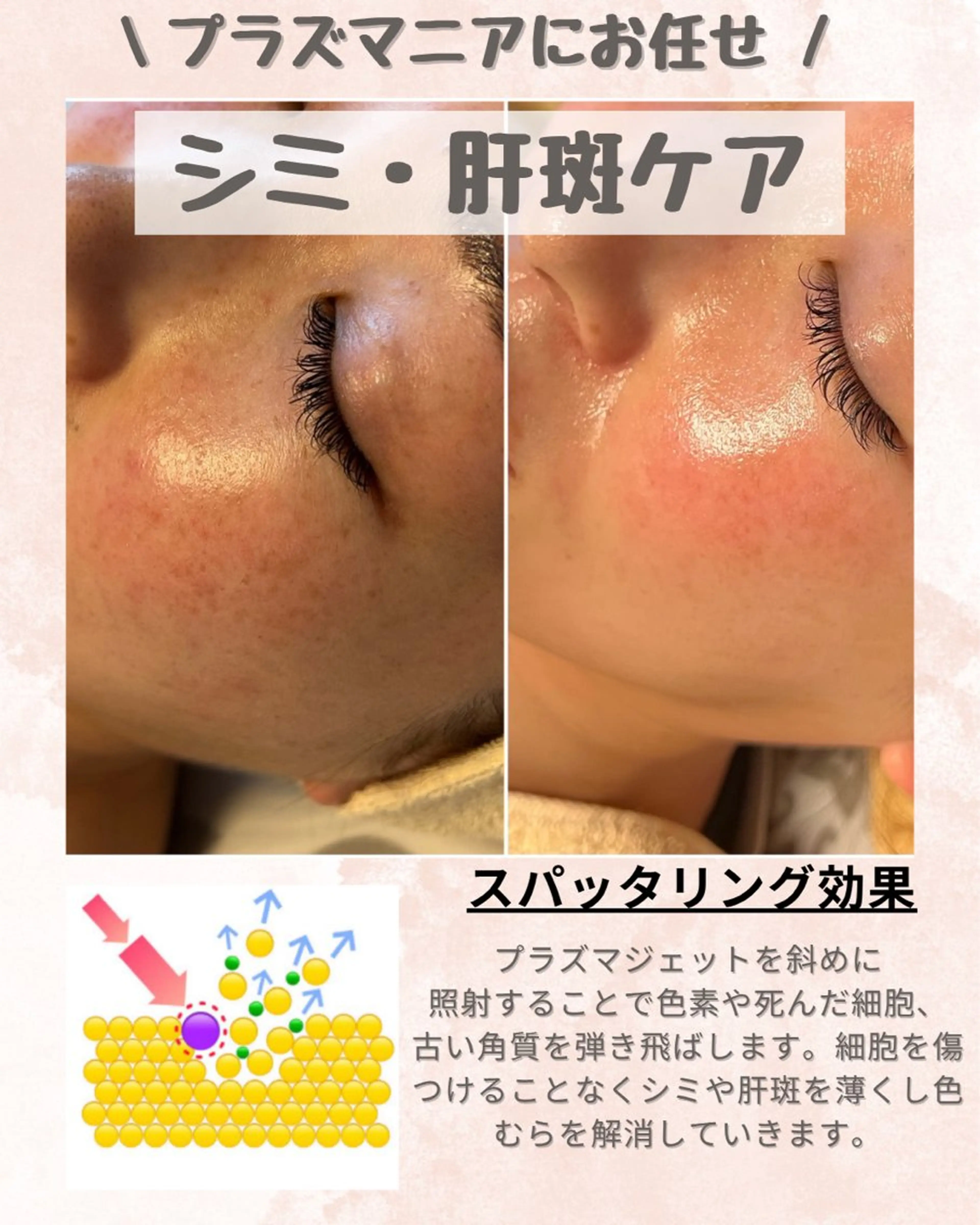 その他 痩身・フェイシャル/if byOrabriller所属・if byOrab riller【イフ】のその他イメージ