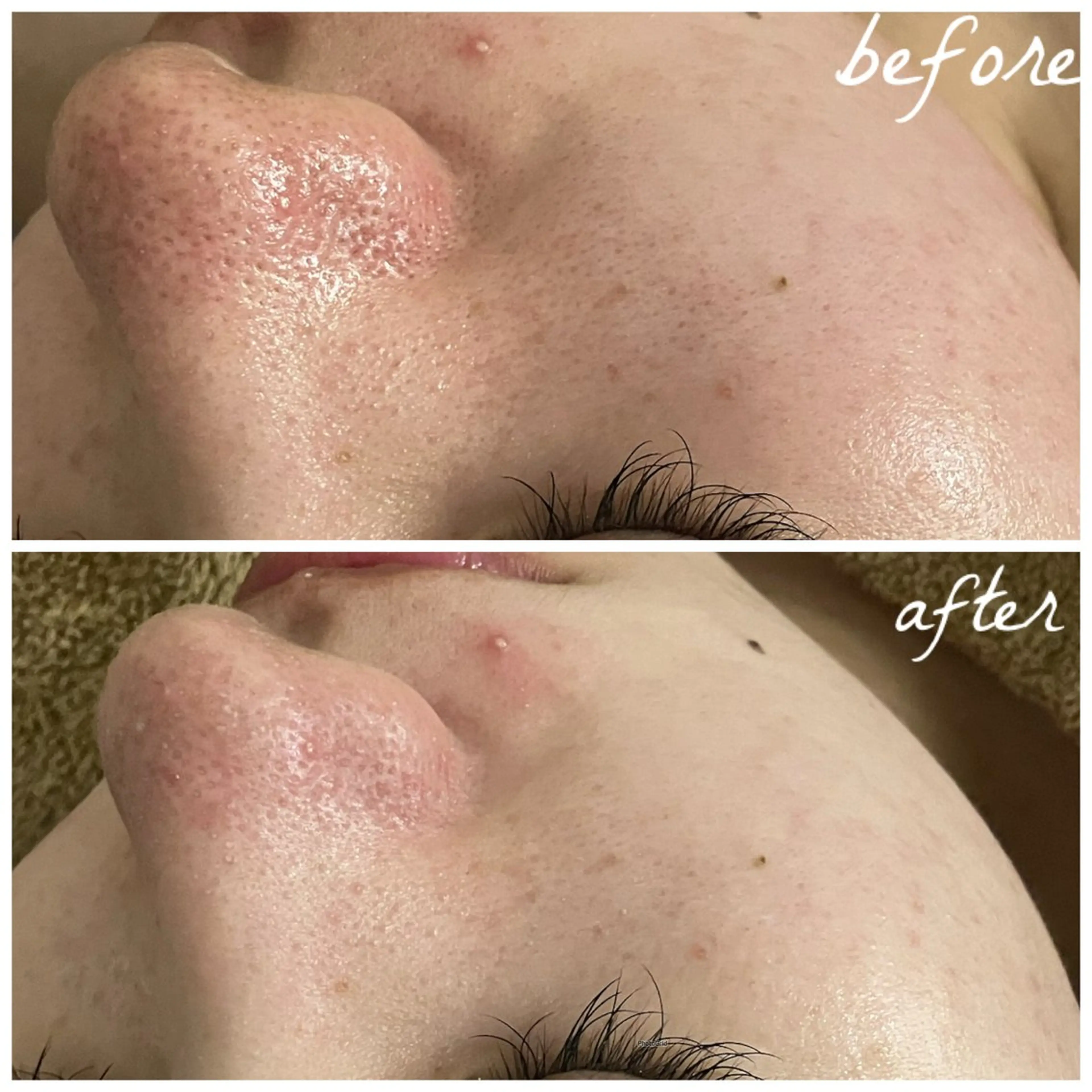 メンズ エステ メナード岐阜茜部 杉浦のエステ・リラクイメージ