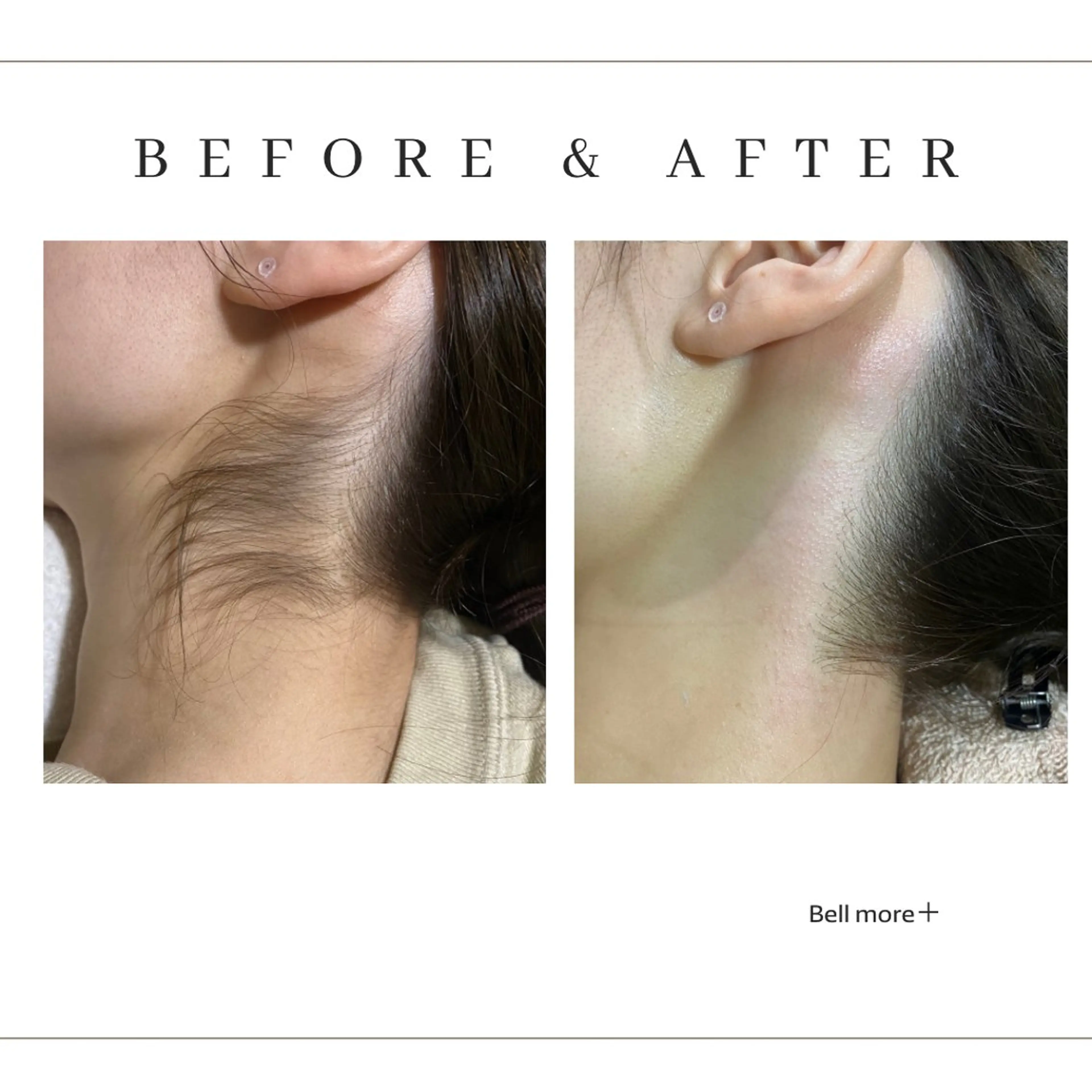 脱毛 Bellmore ＋のエステ・リラクイメージ