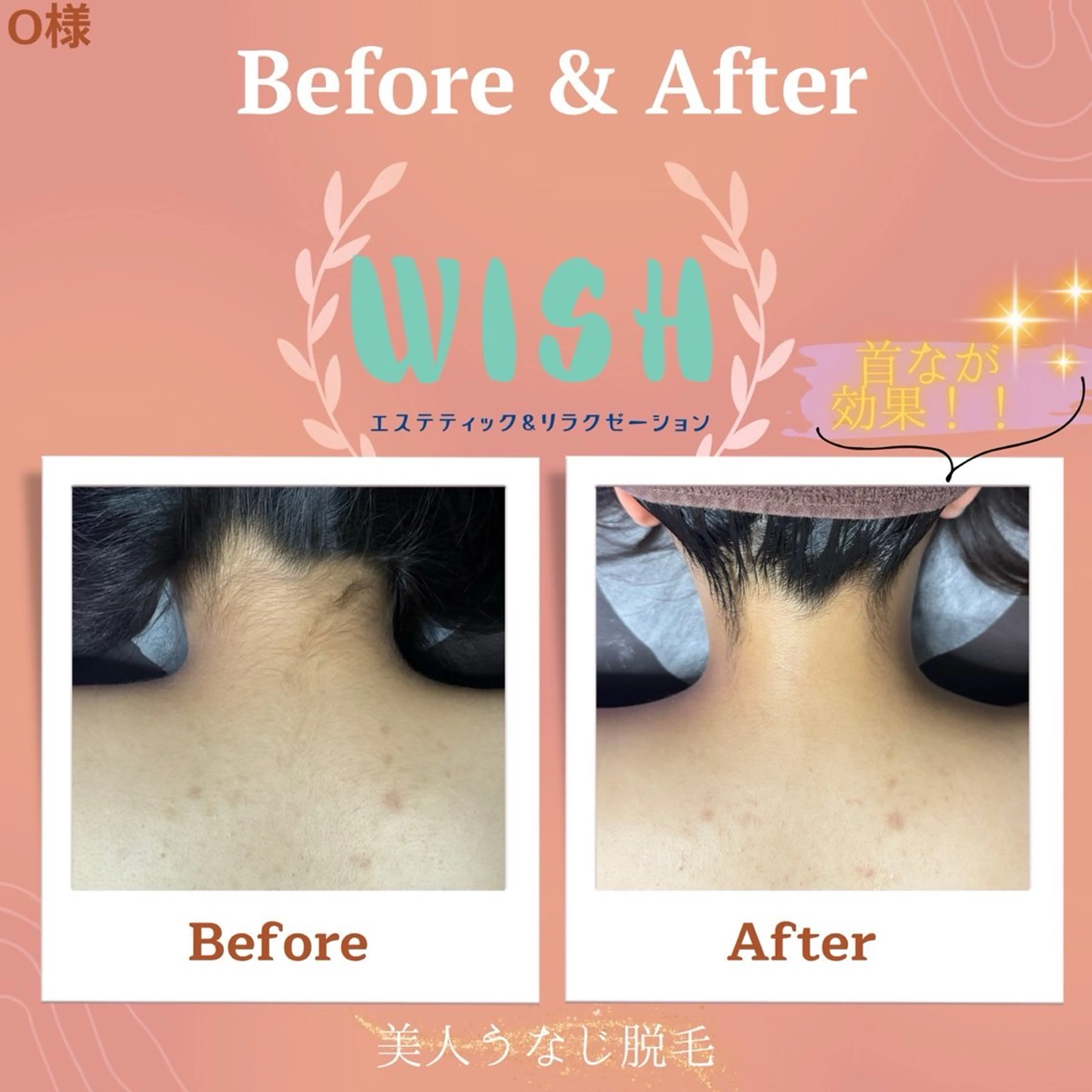 WISH 美肌脱毛のプロ！須藤のエステ・リラクイメージ