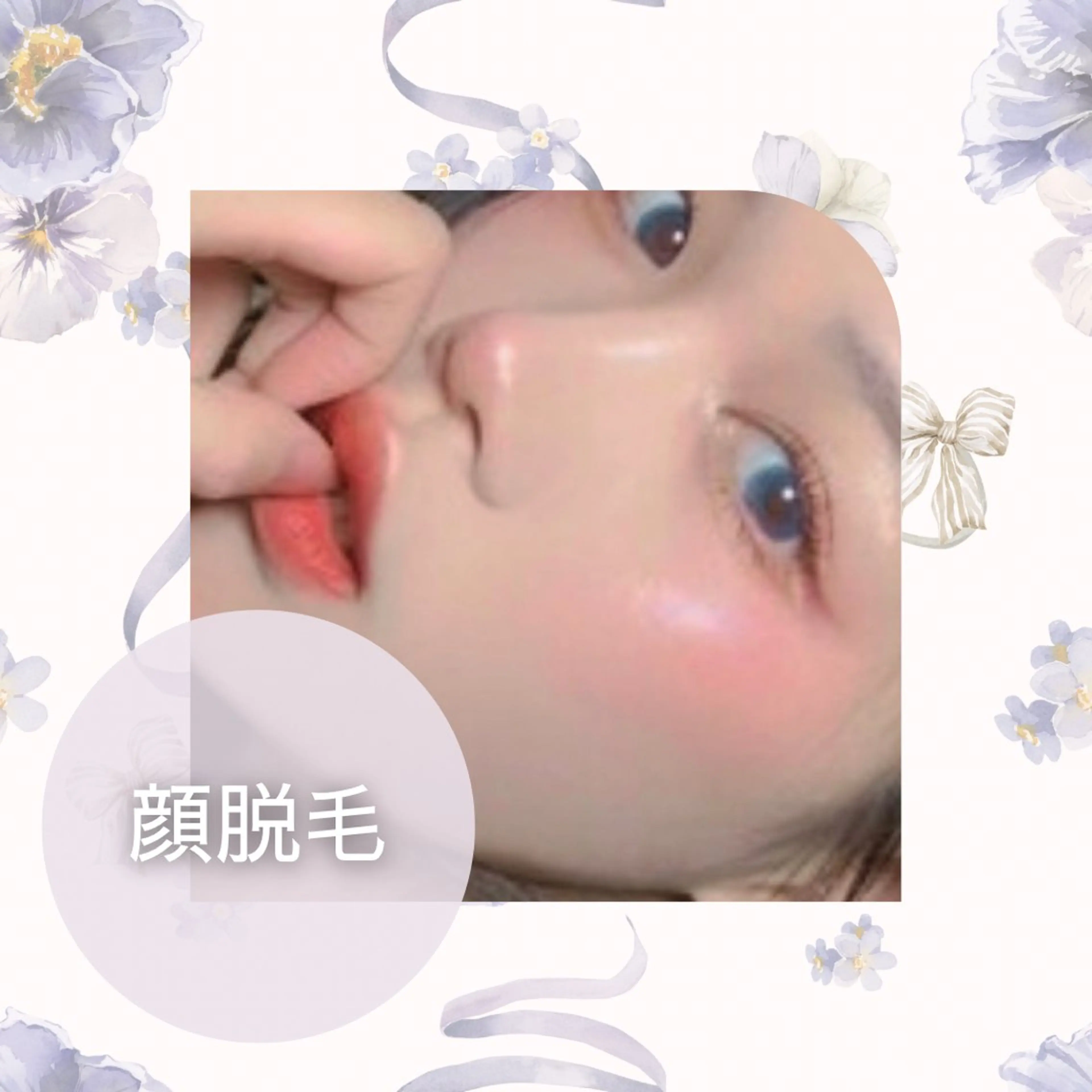 脱毛 美肌脱毛&毛穴専門 Nico🐰ྀི♡のエステ・リラクイメージ