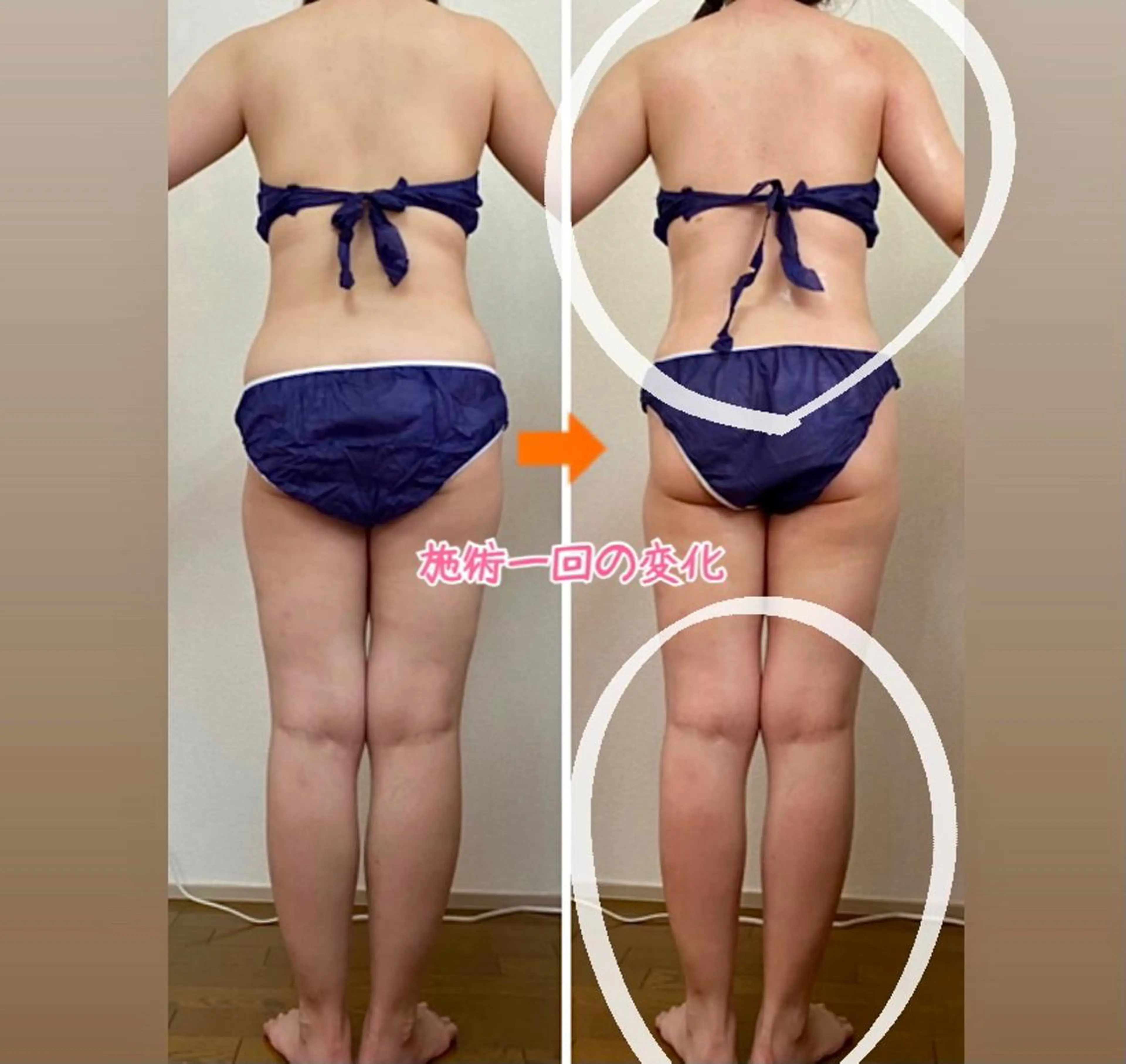 ショート カラー パーマ ヘアアレンジ メンズ キッズ ネイル マツエク・マツパ ‍痩身＆ボディ 結果出し🌟丹野のエステ・リラクイメージ