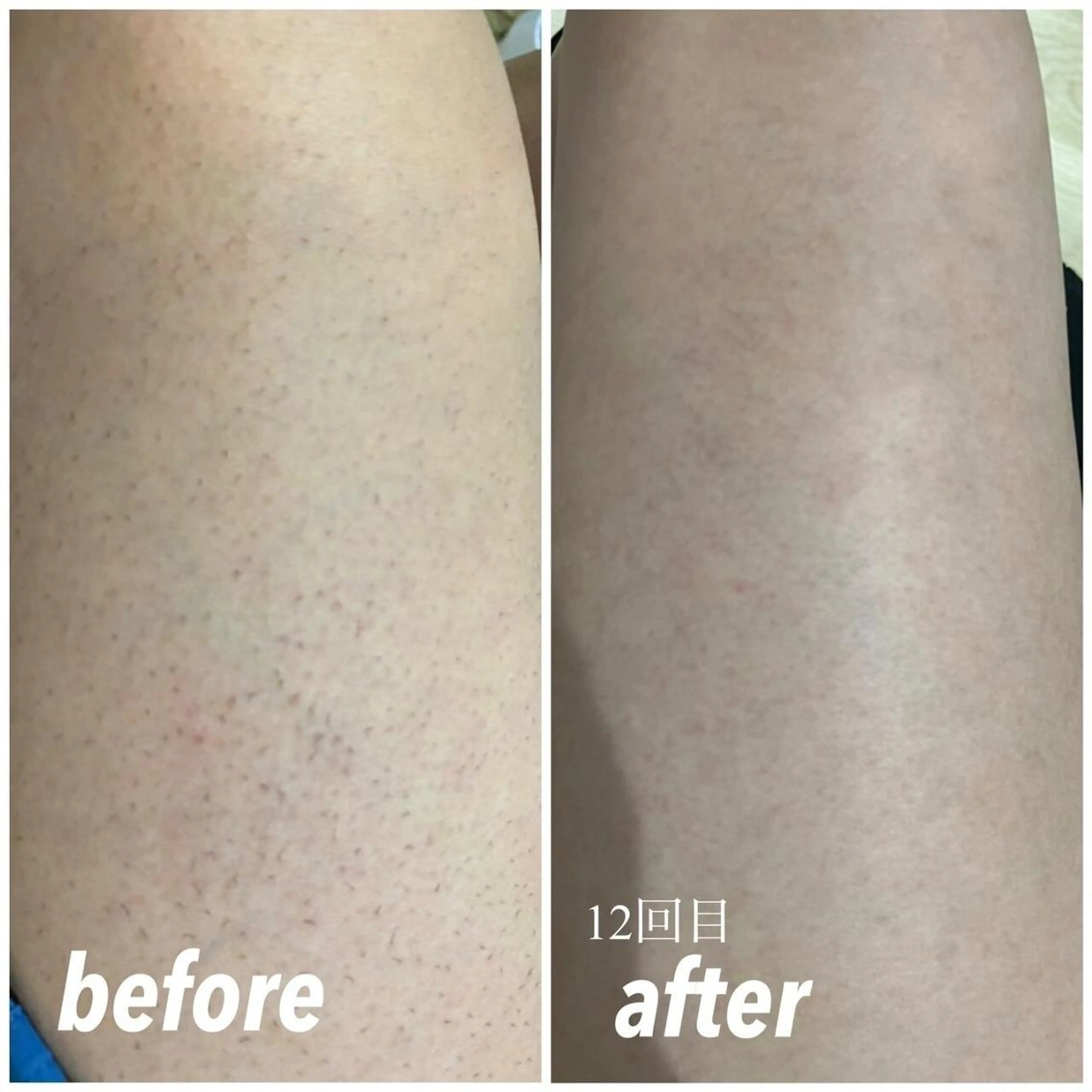 SELFMADE 石巻店のエステ・リラクイメージ