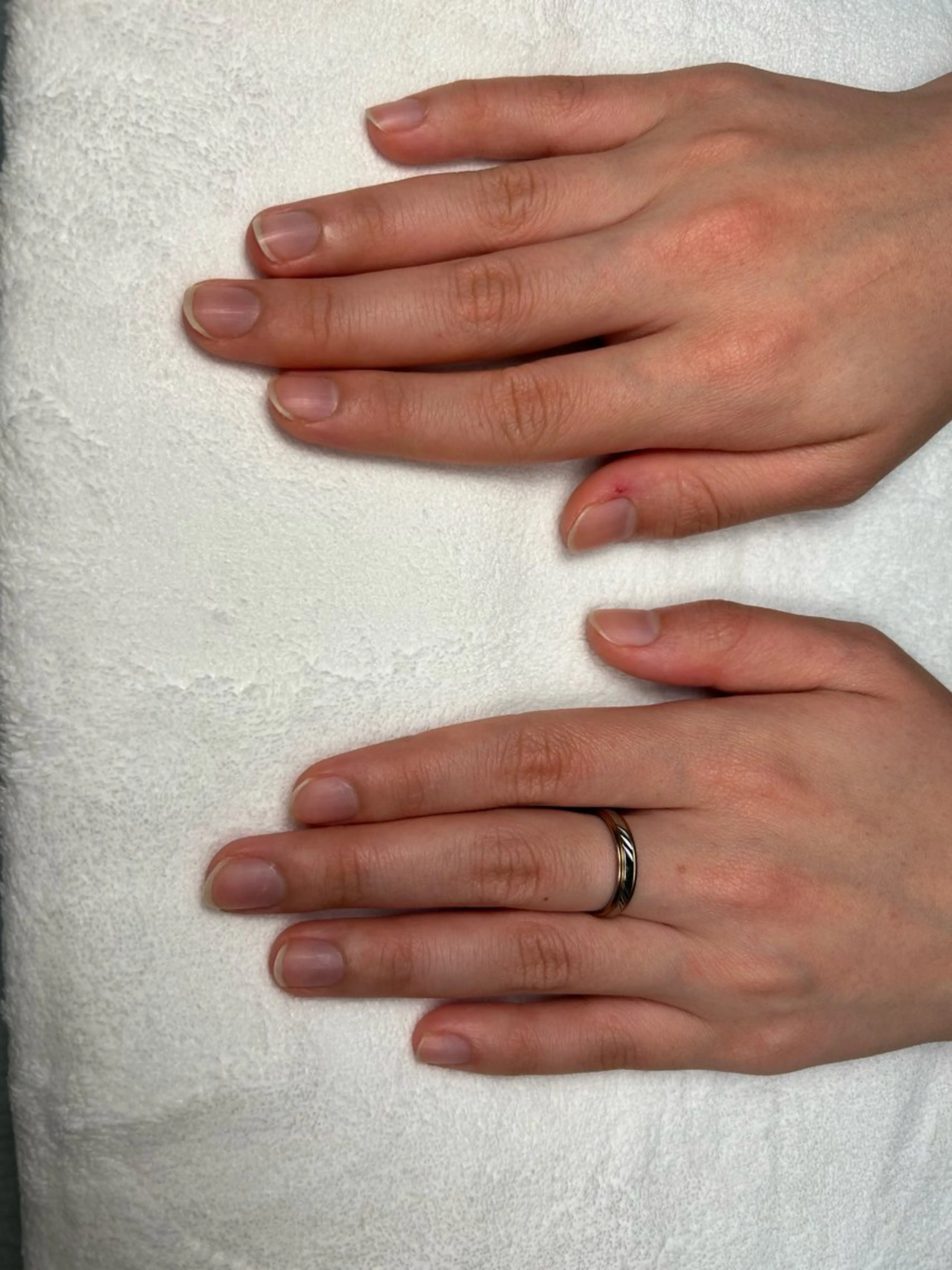 ハンドケア(整爪、甘皮処理)の写真