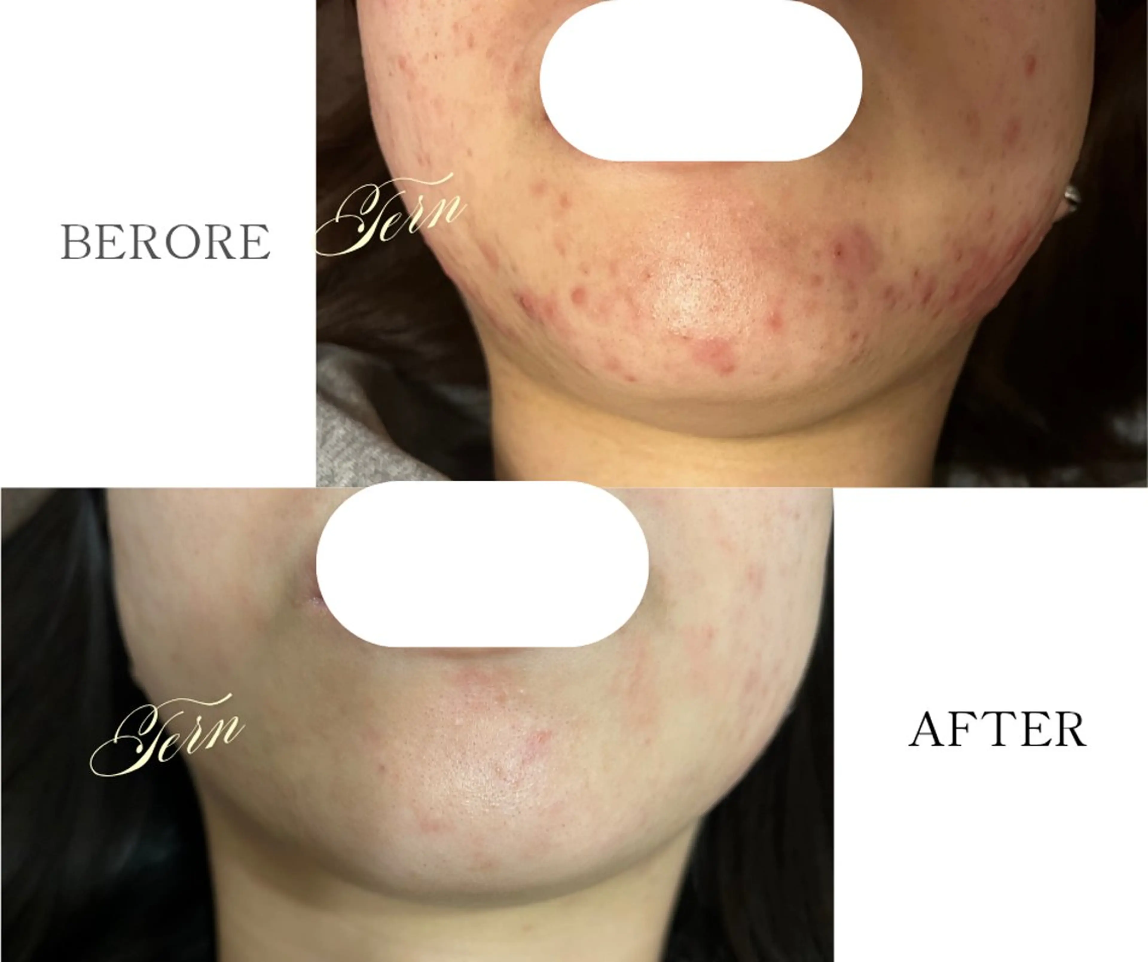 小顔・ニキビ・肌管理 TERN 南草津店のエステ・リラクイメージ