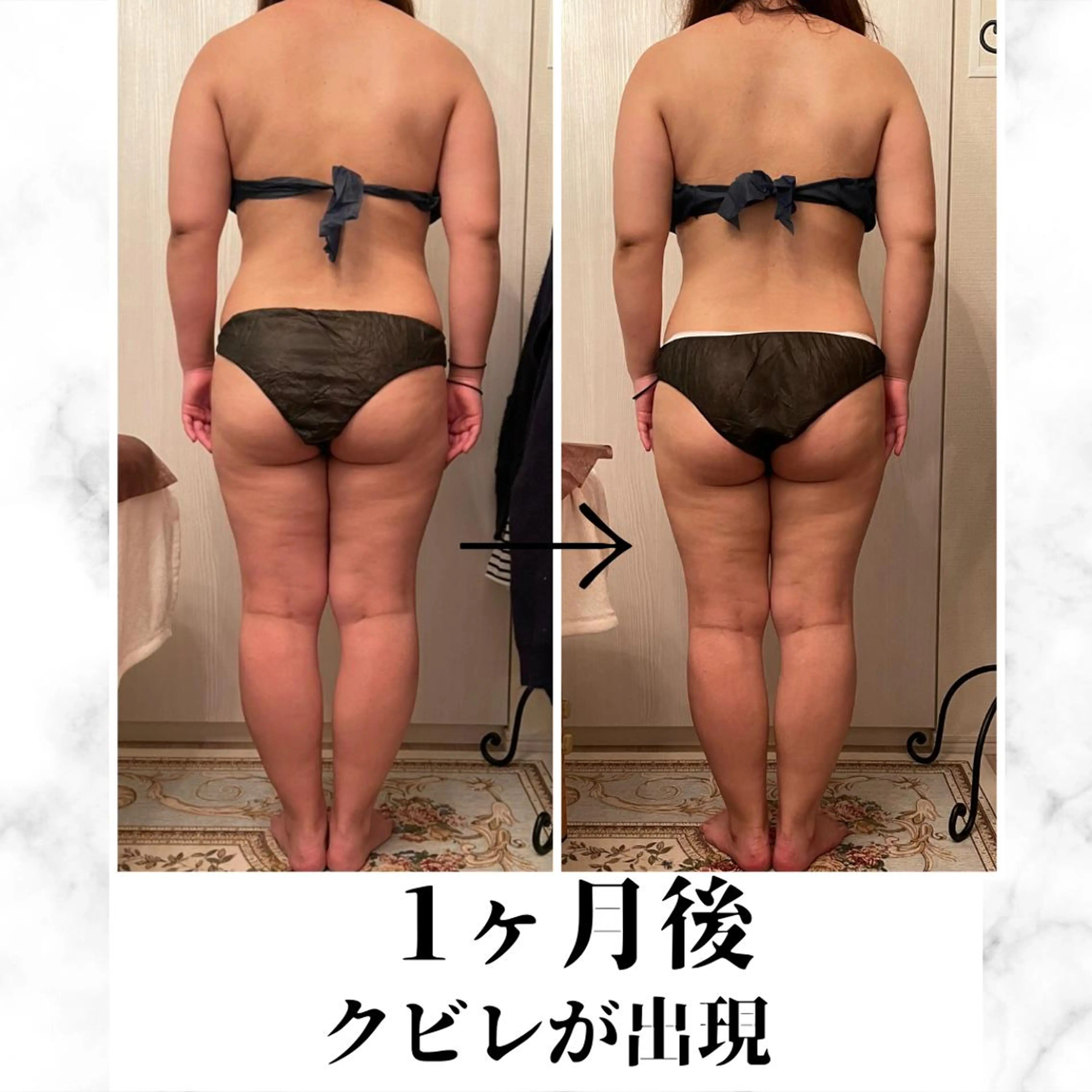 食べながら魅せボディ éclatJua川越のエステ・リラクイメージ