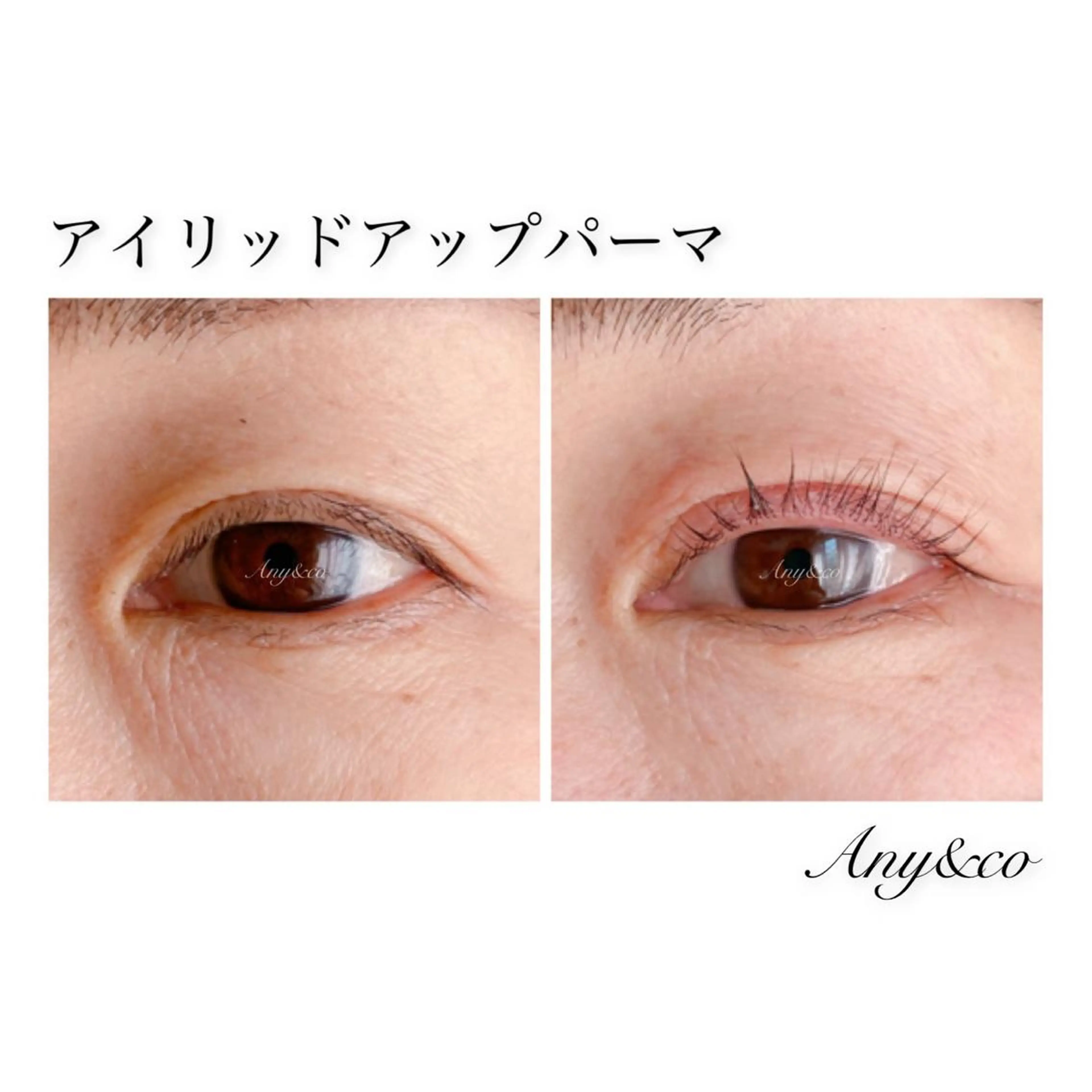 マツエク・マツパ アイリッドアップパーマ Any&co 【エニコ】のマツエク・マツパデザイン