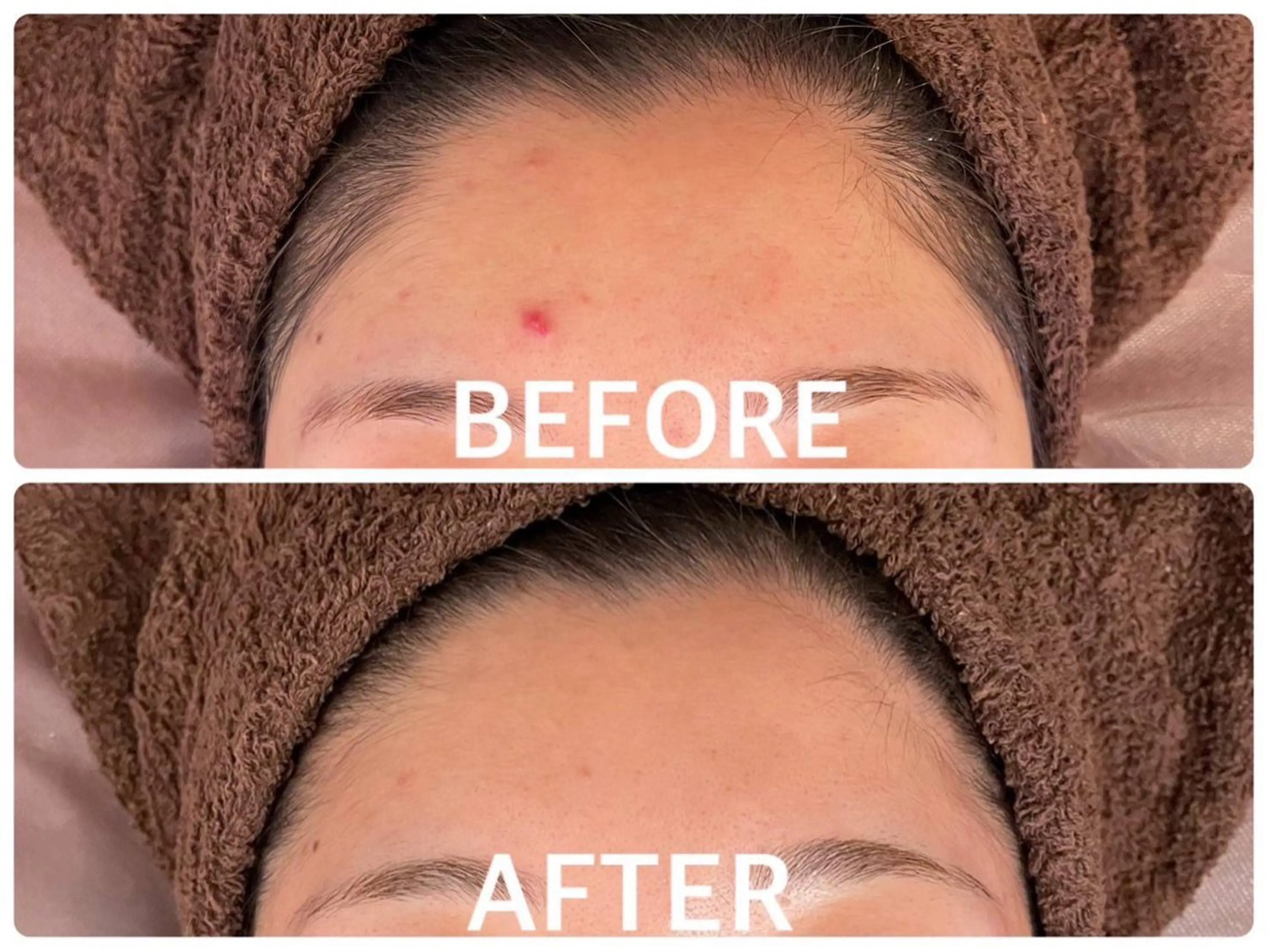 ハーブピーリング 🌿京橋のエステ・リラクイメージ