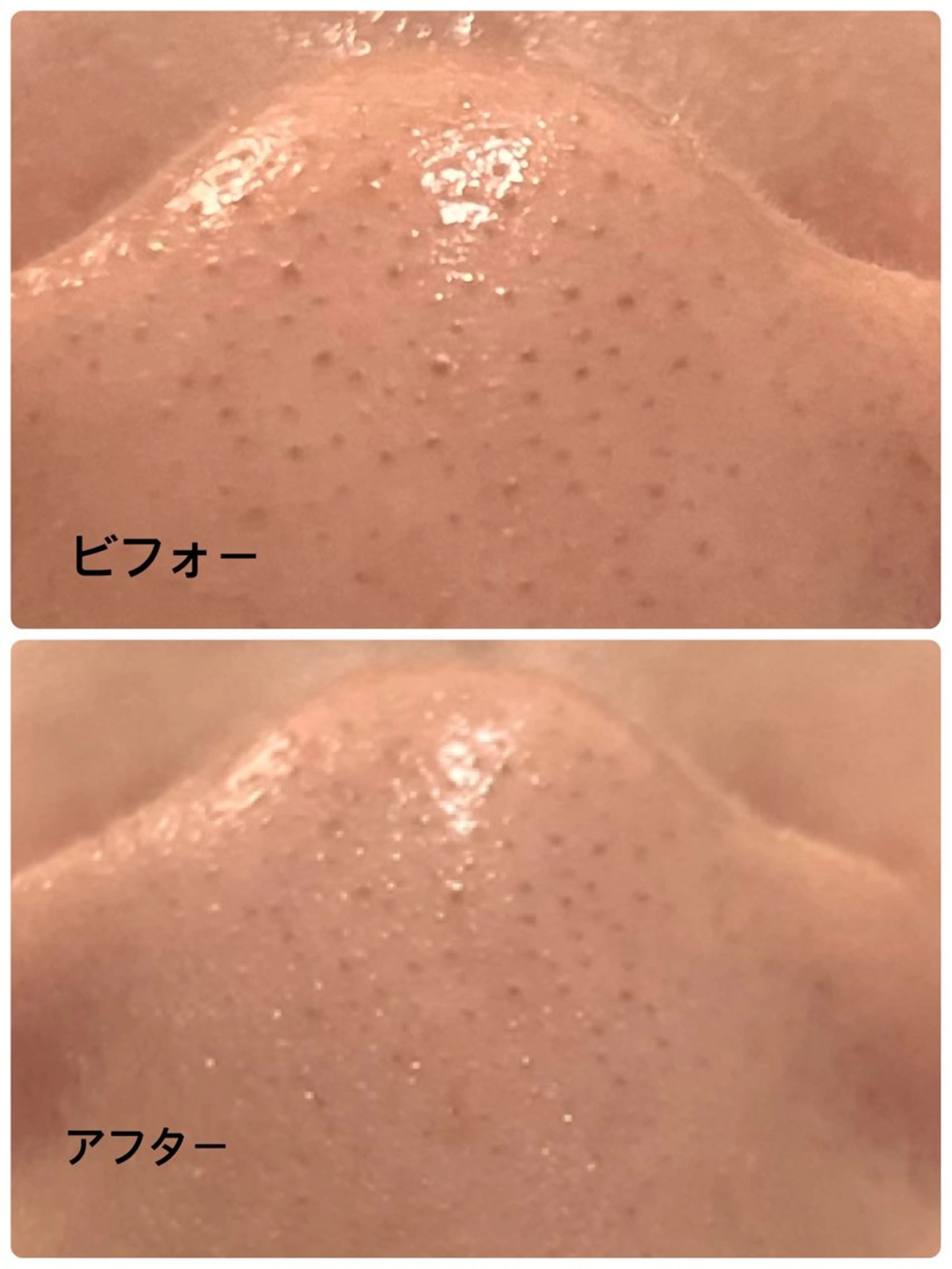 エステ お肌と歯のサロン　Sona Mior所属・藤井 ののみのエステ・リラクイメージ