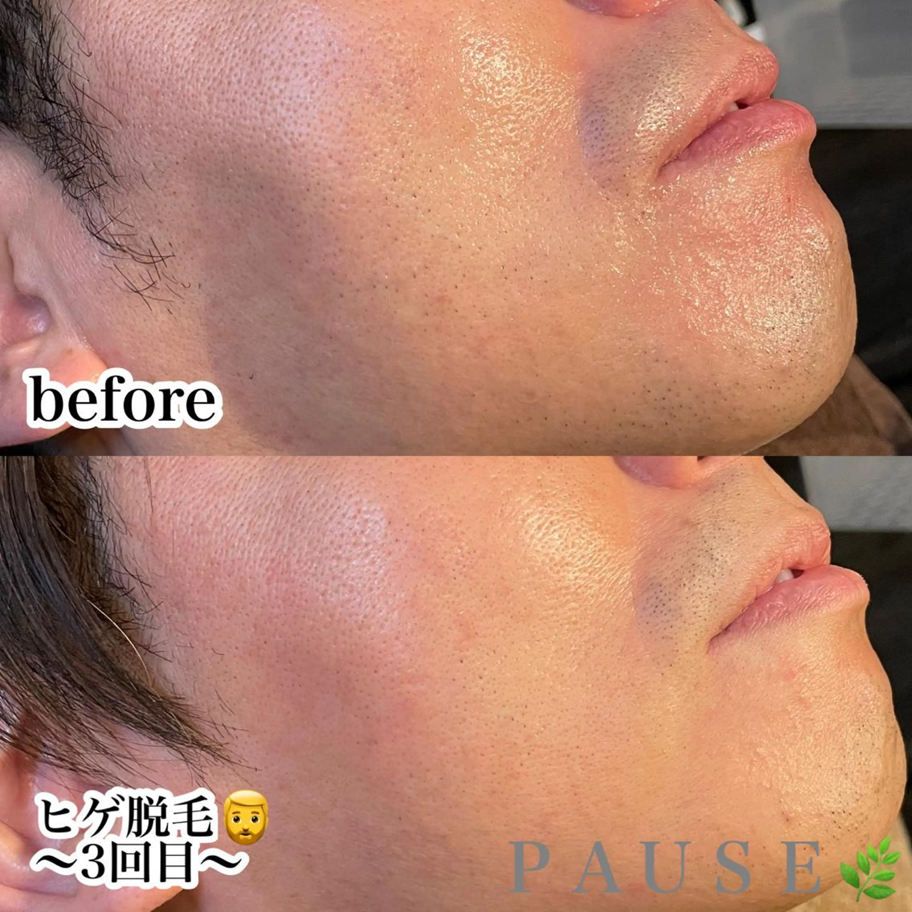 脱毛 浜野 恵美のエステ・リラクイメージ