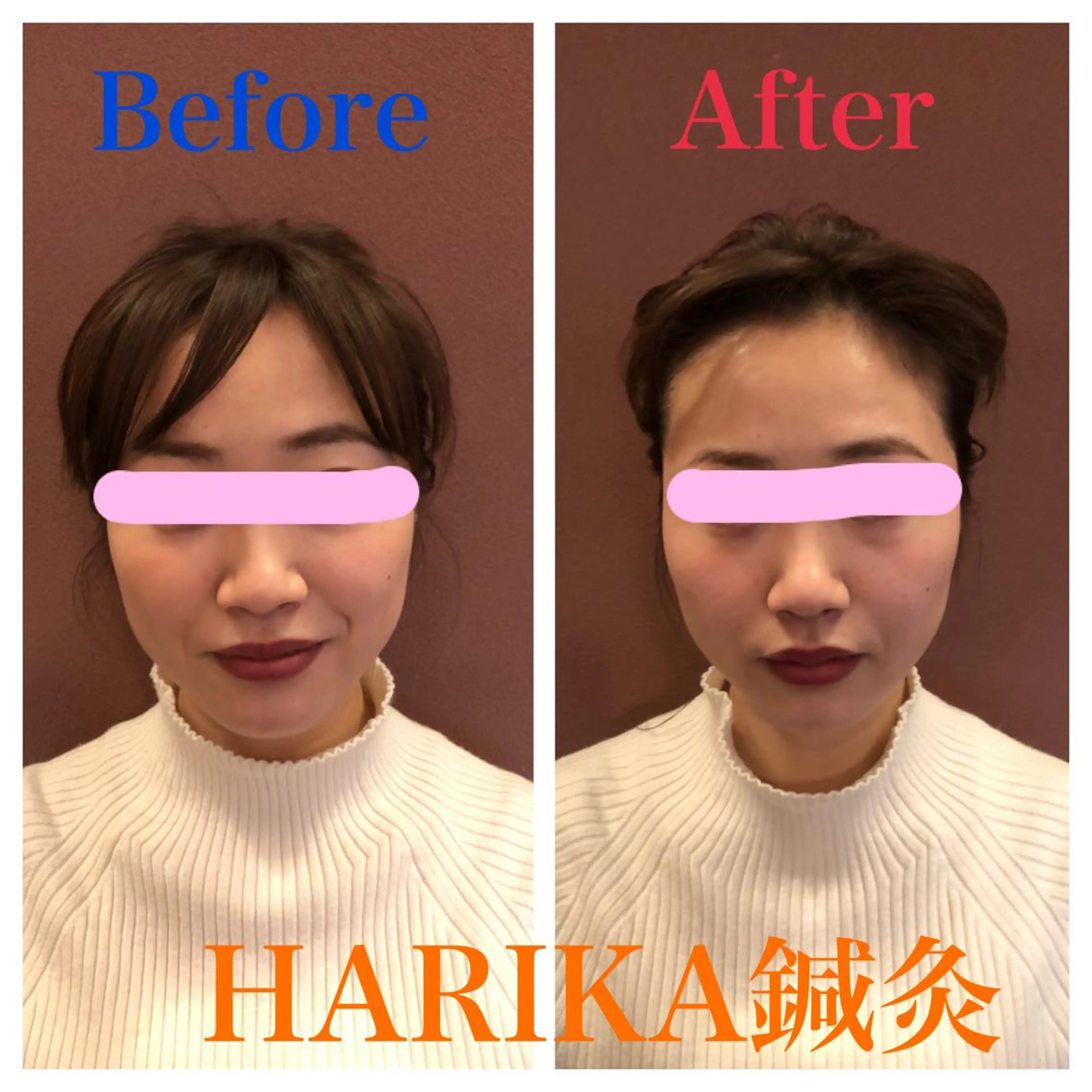 HARIKA鍼灸所属・HARIKA 鍼灸のその他イメージ