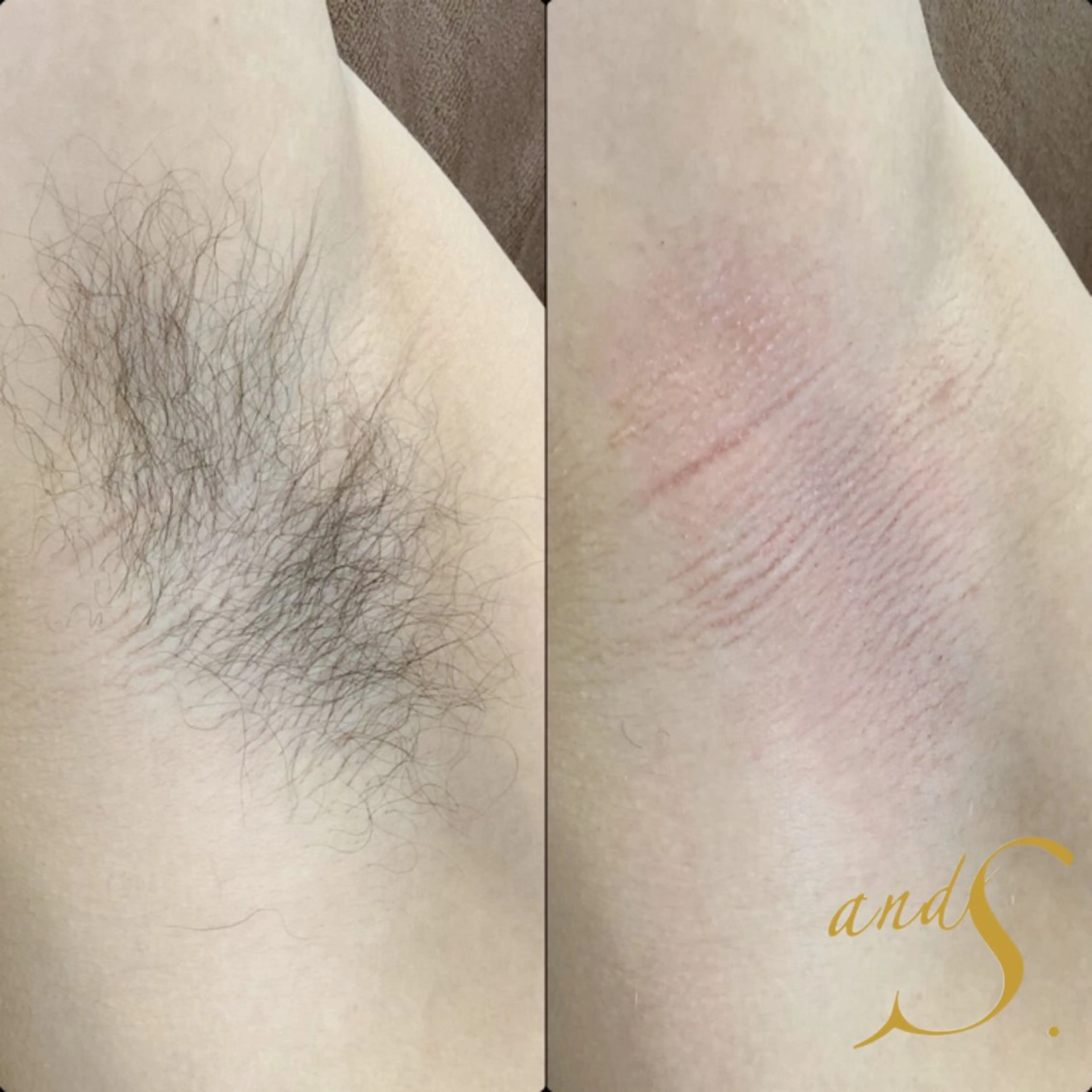 メンズ 脱毛 🌸🧡六本木 脱毛しずか🧡🫧の眉毛・アイブロウイメージ