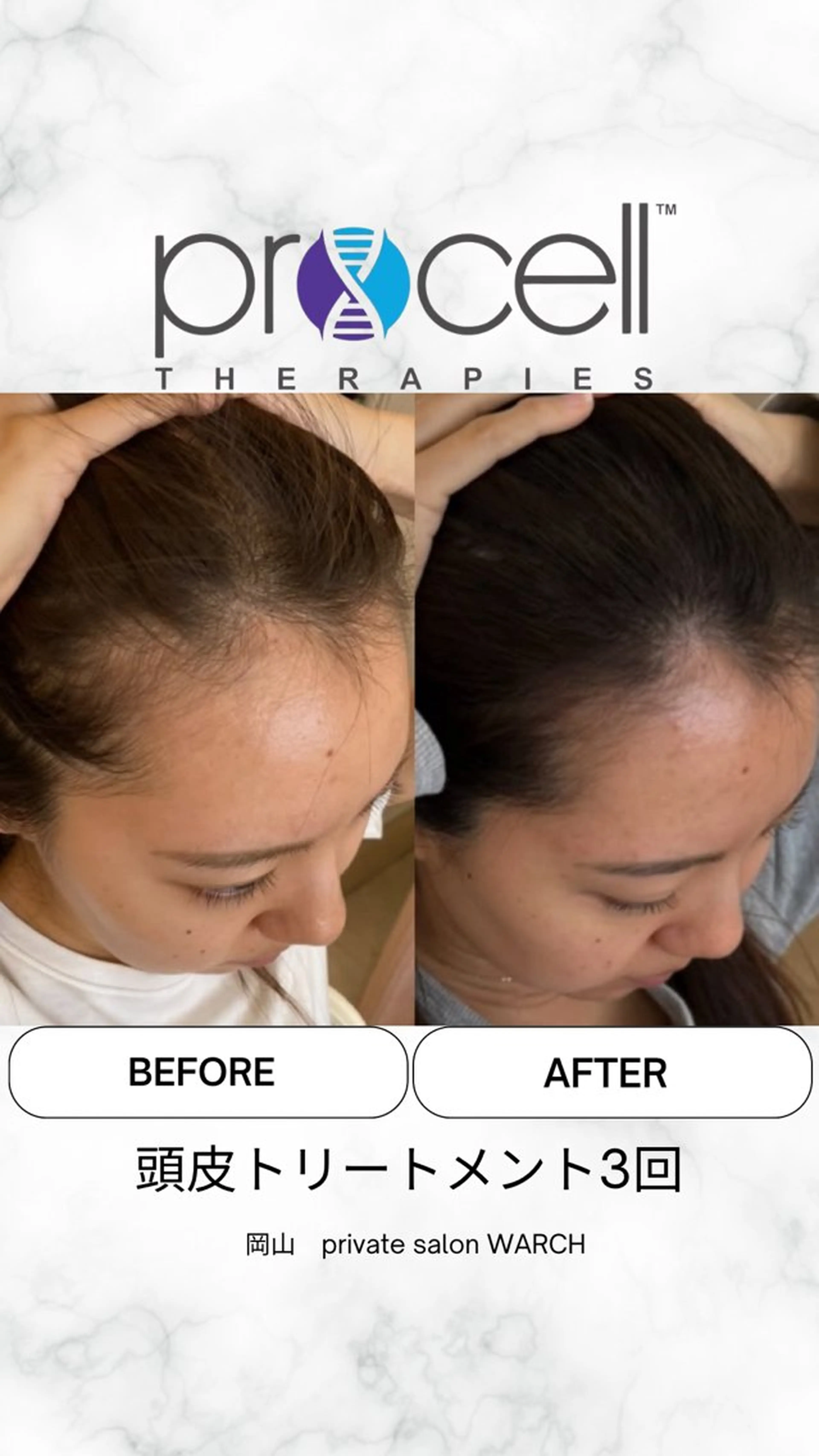 WARCH Marieのその他イメージ