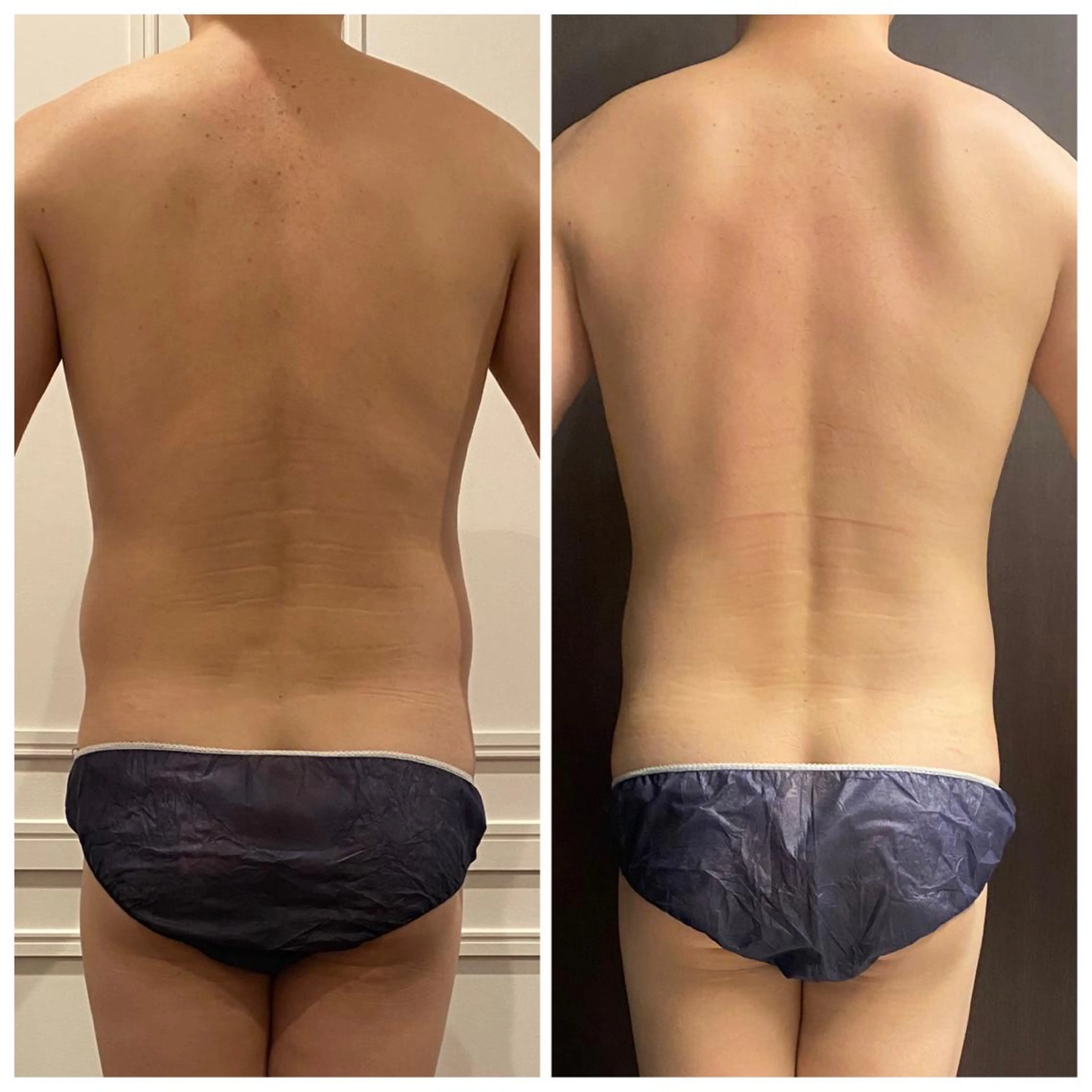 エステ リラク 通うほど変わる本格 エステ心斎橋REVIのエステ・リラクイメージ