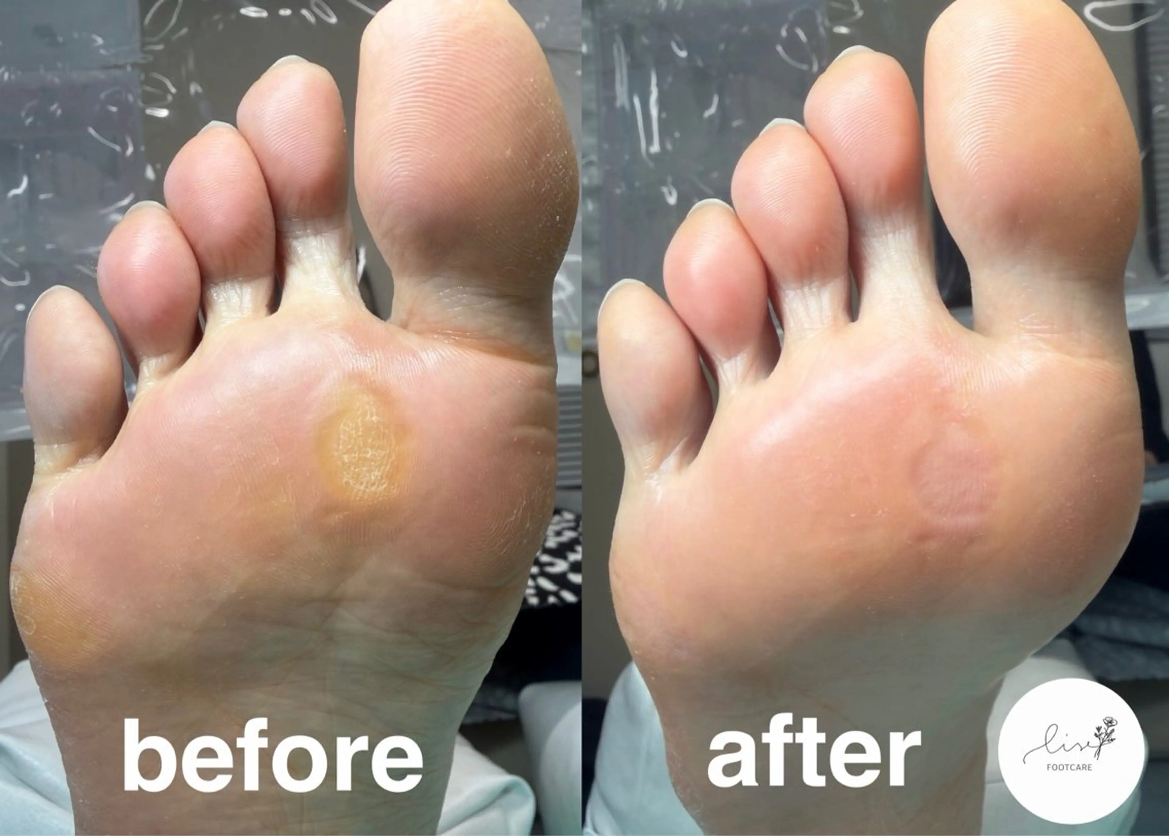 その他(ネイル) Lise footcareのネイルデザイン