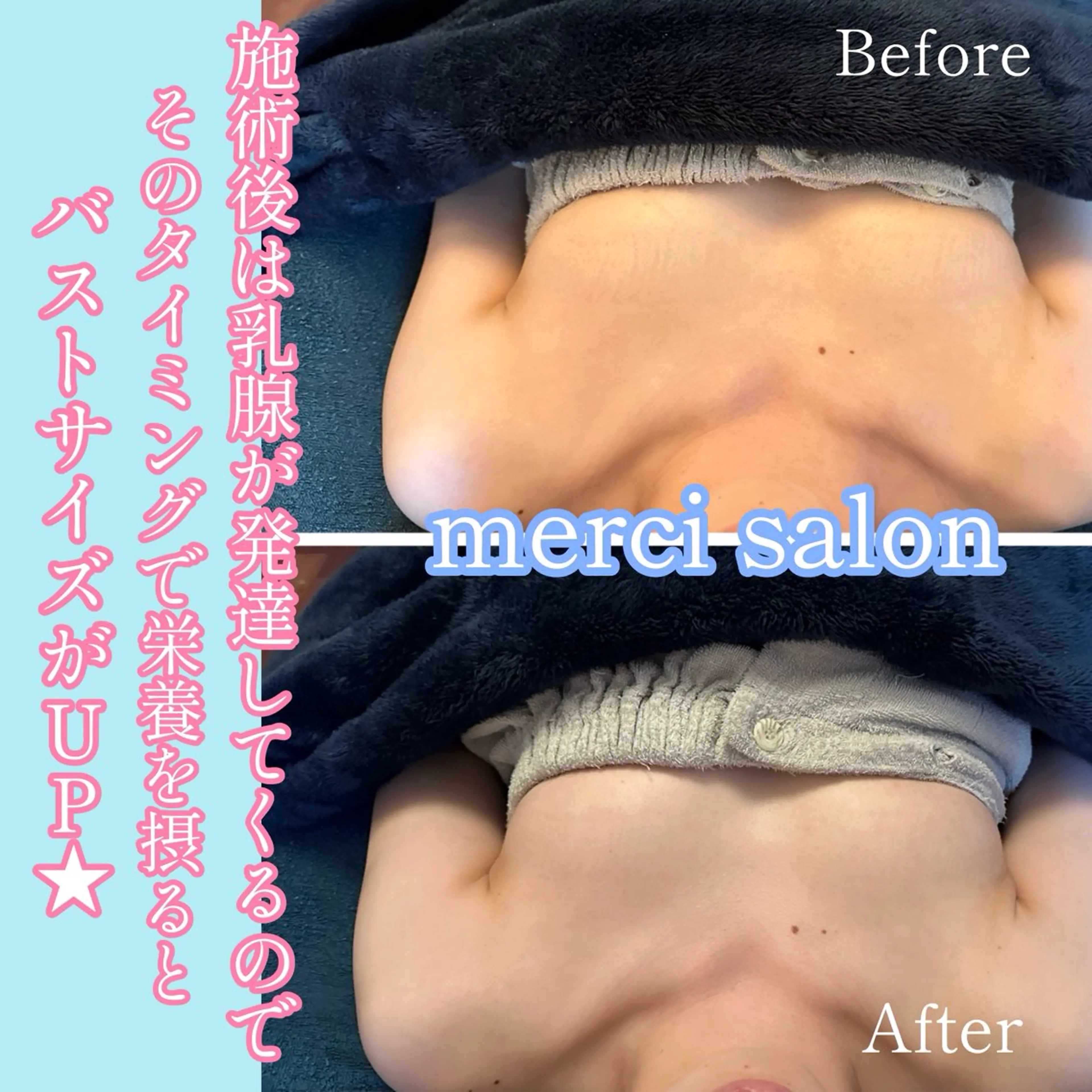 エステ merci  salon所属・バストアップ特化/デ トックス/小顔/脱毛のエステ・リラクイメージ