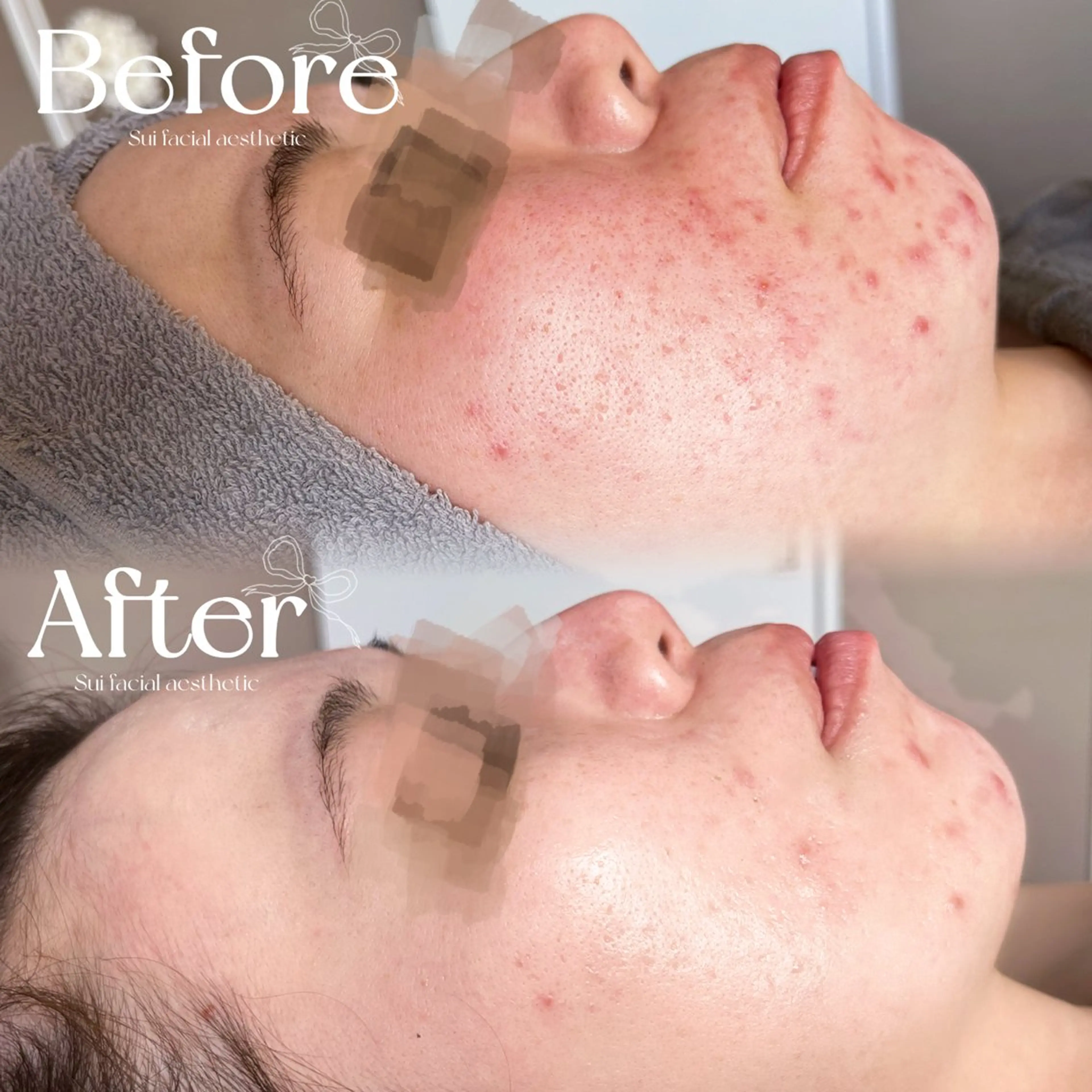 エステ Sui所属・Sui Eye & Beautyのマツエク・マツパデザイン