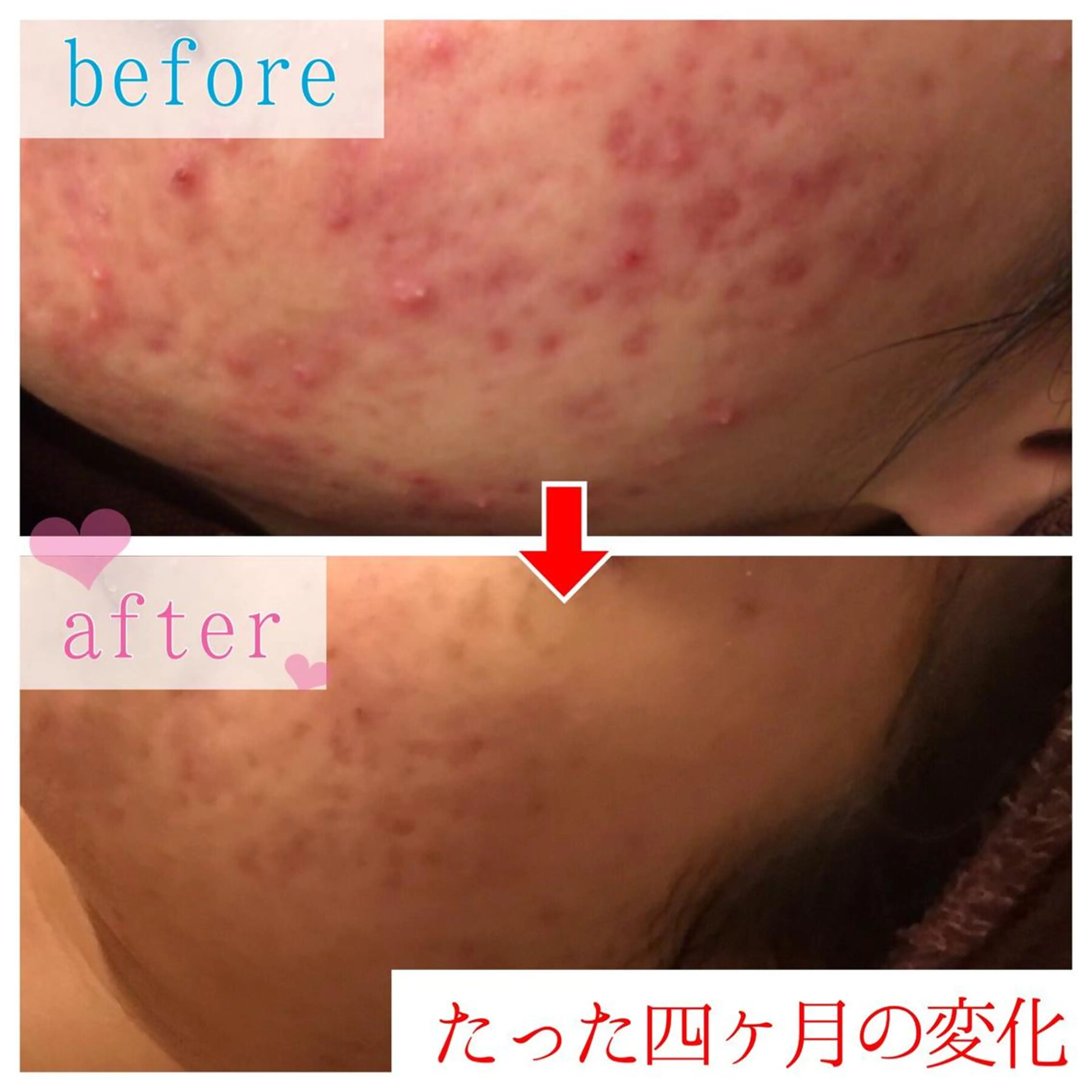 ミディアム カラー パーマ ヘアアレンジ メンズ キッズ ネイル マツエク・マツパ 四つ星サロン🎖 腸＆ニキビケアに特化のエステ・リラクイメージ