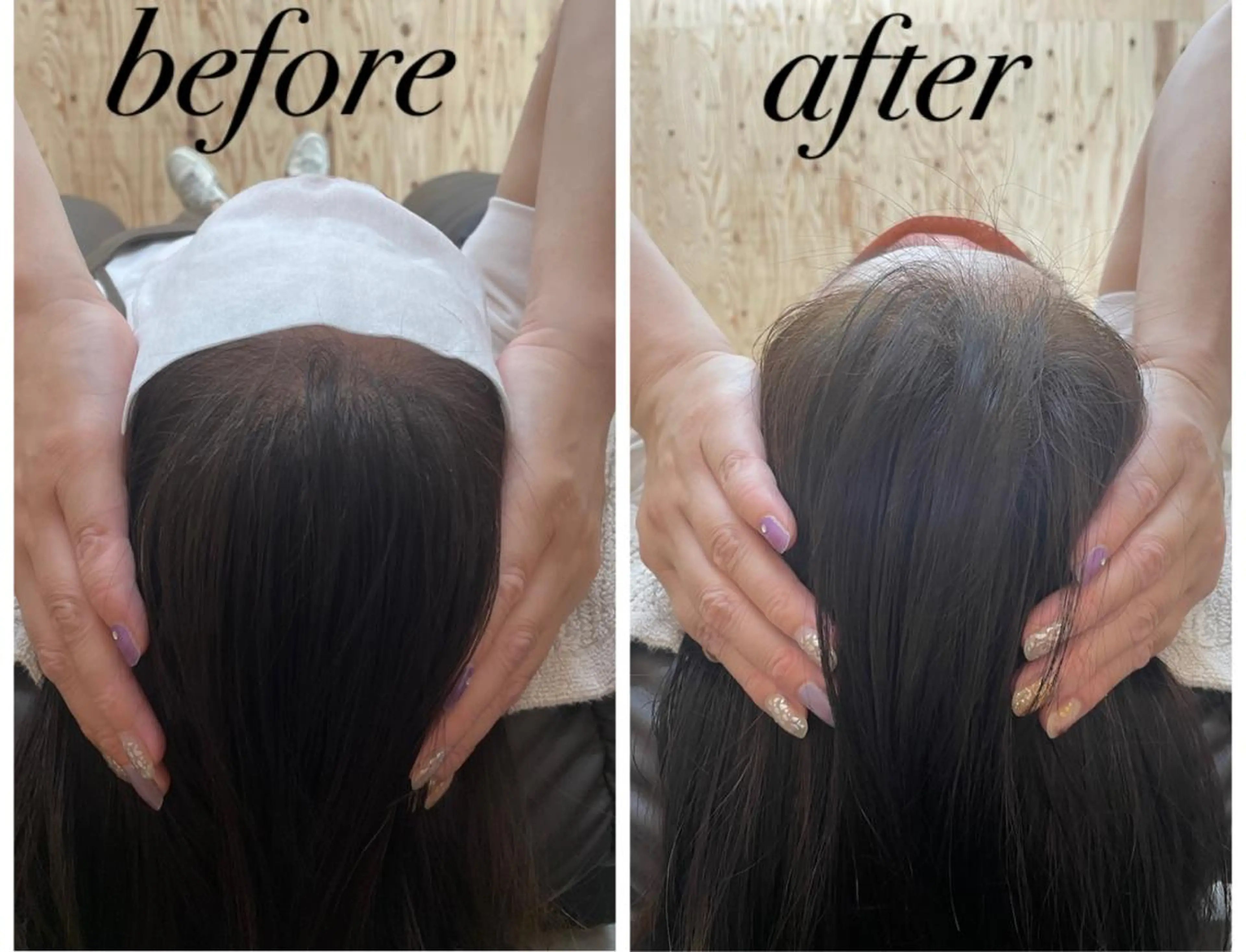 リラク ate'所属・個室ドライヘッドスパ 🍃moriのエステ・リラクイメージ