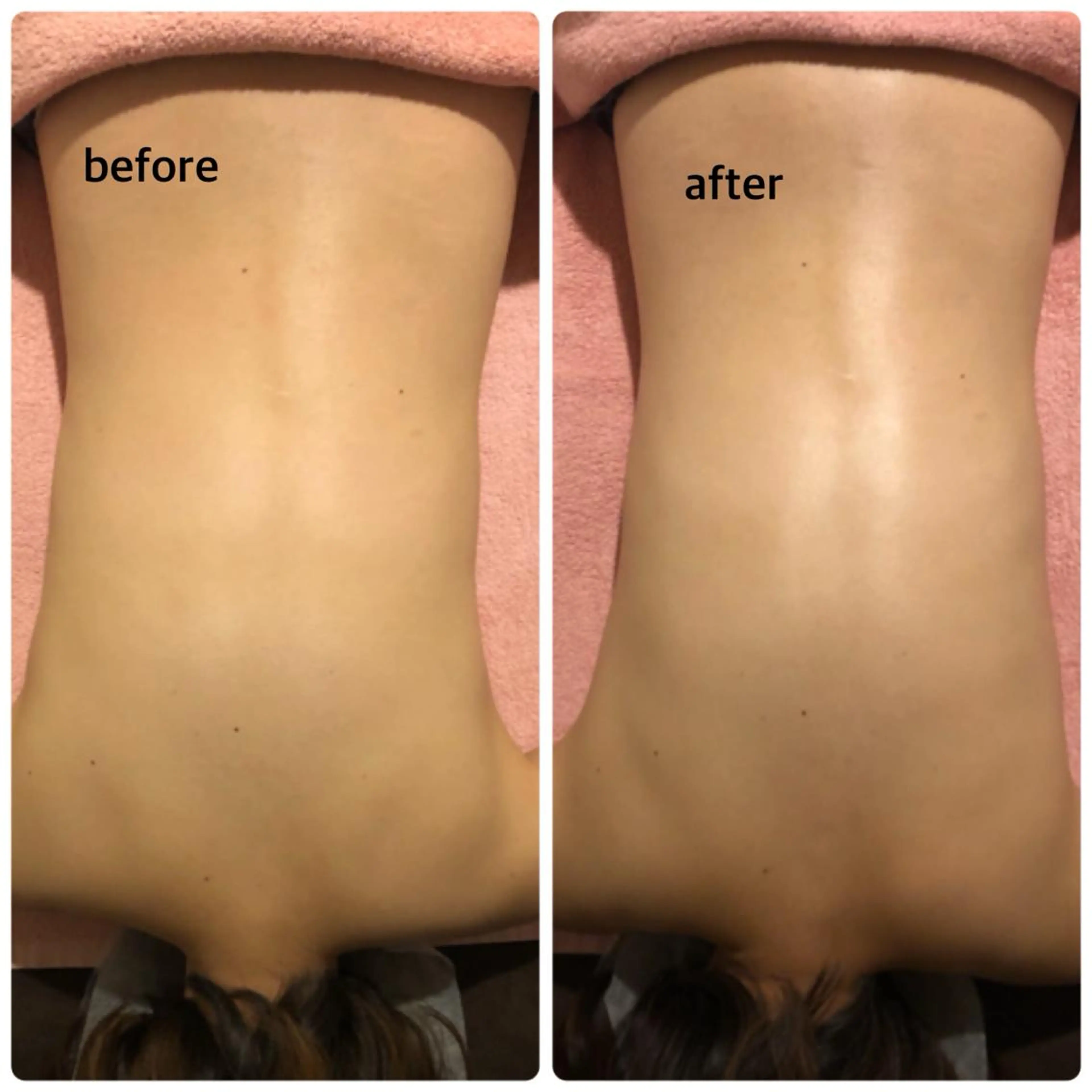 未病ケアサロン EMINY所属・未病ケアサロン EMINY☺︎勝俣のエステ・リラクイメージ