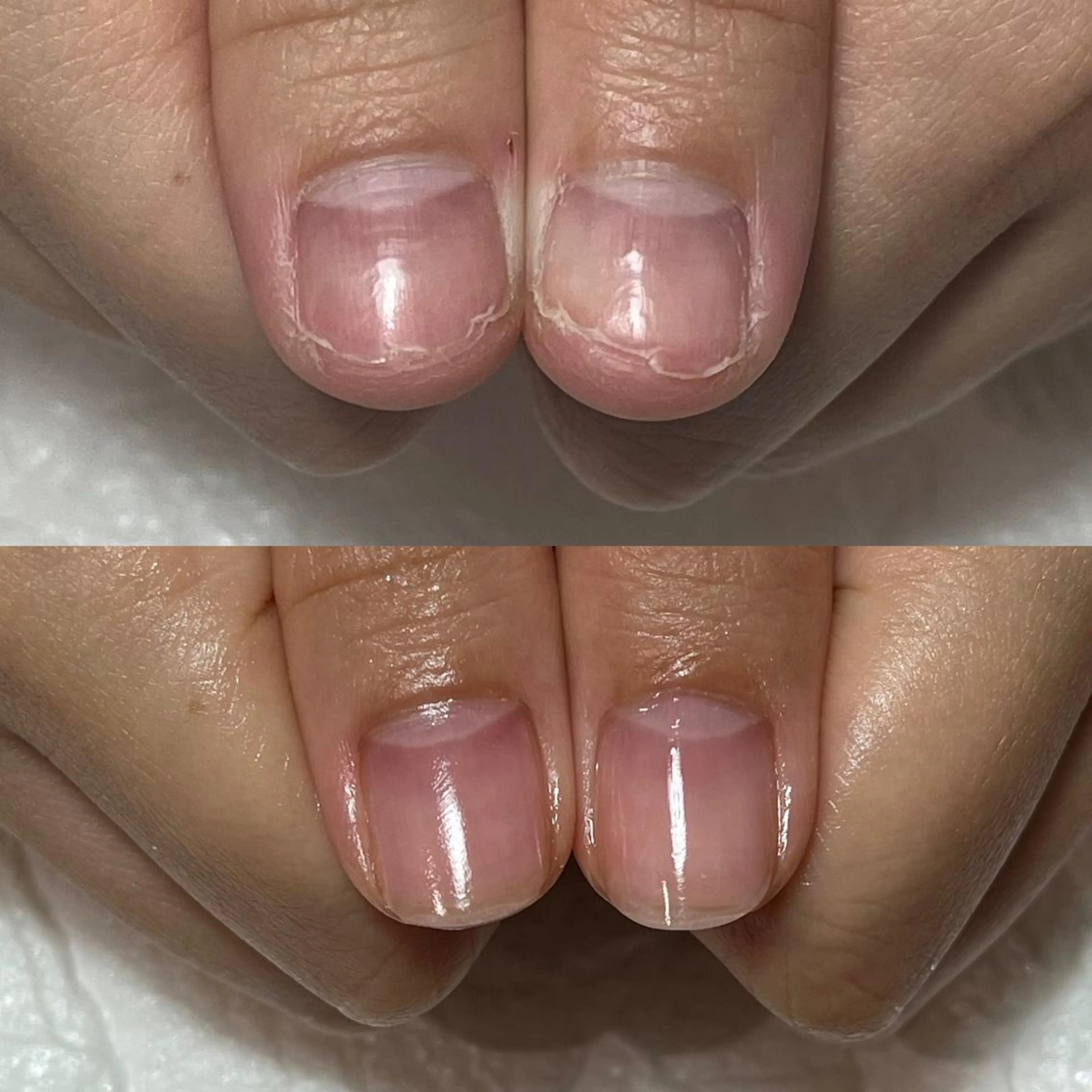 ネイル ジェルネイル 自爪育成・巻き爪 補正講師 津蔵のネイルデザイン