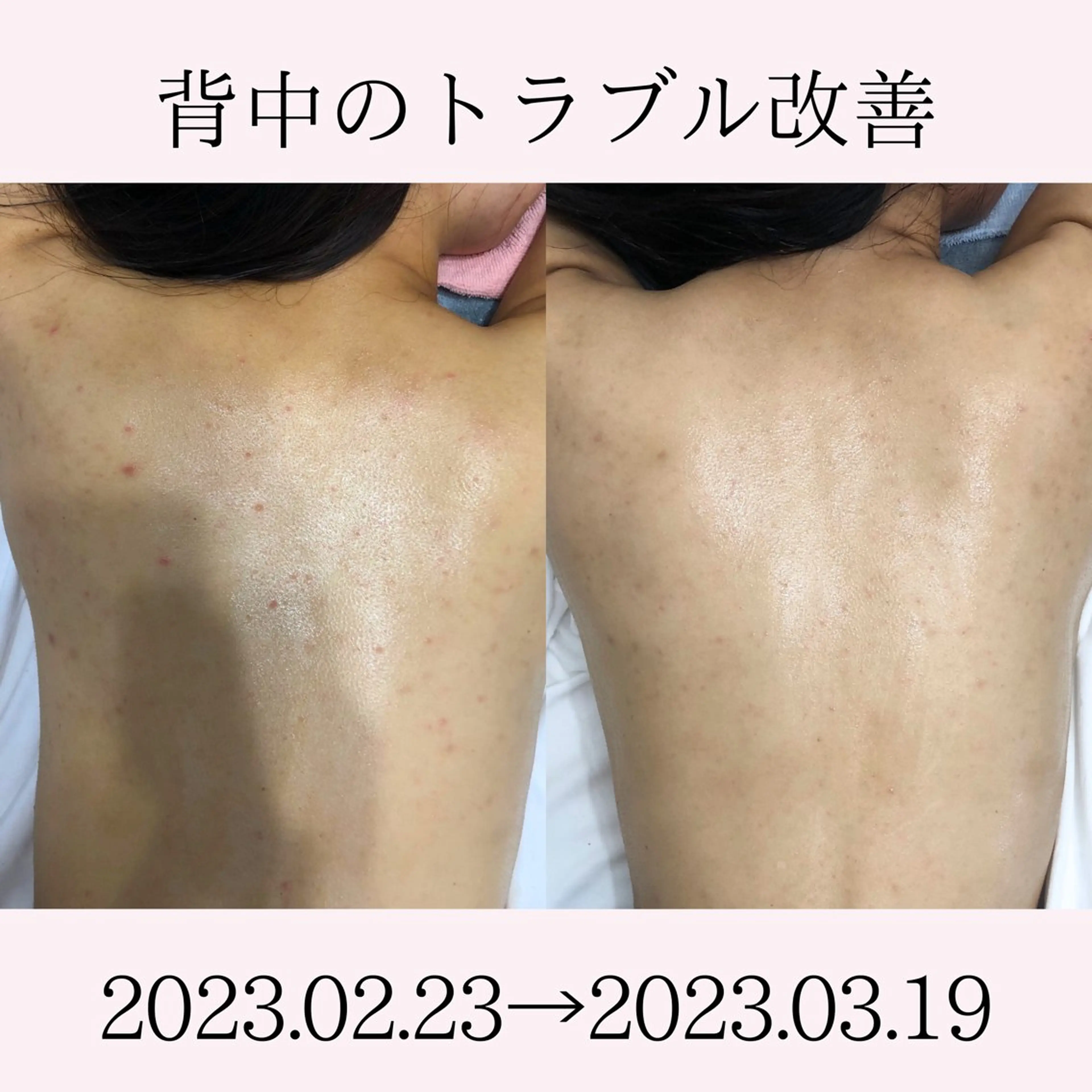 エステ BestBelleꕤ 大阪福島/肌質改善のエステ・リラクイメージ