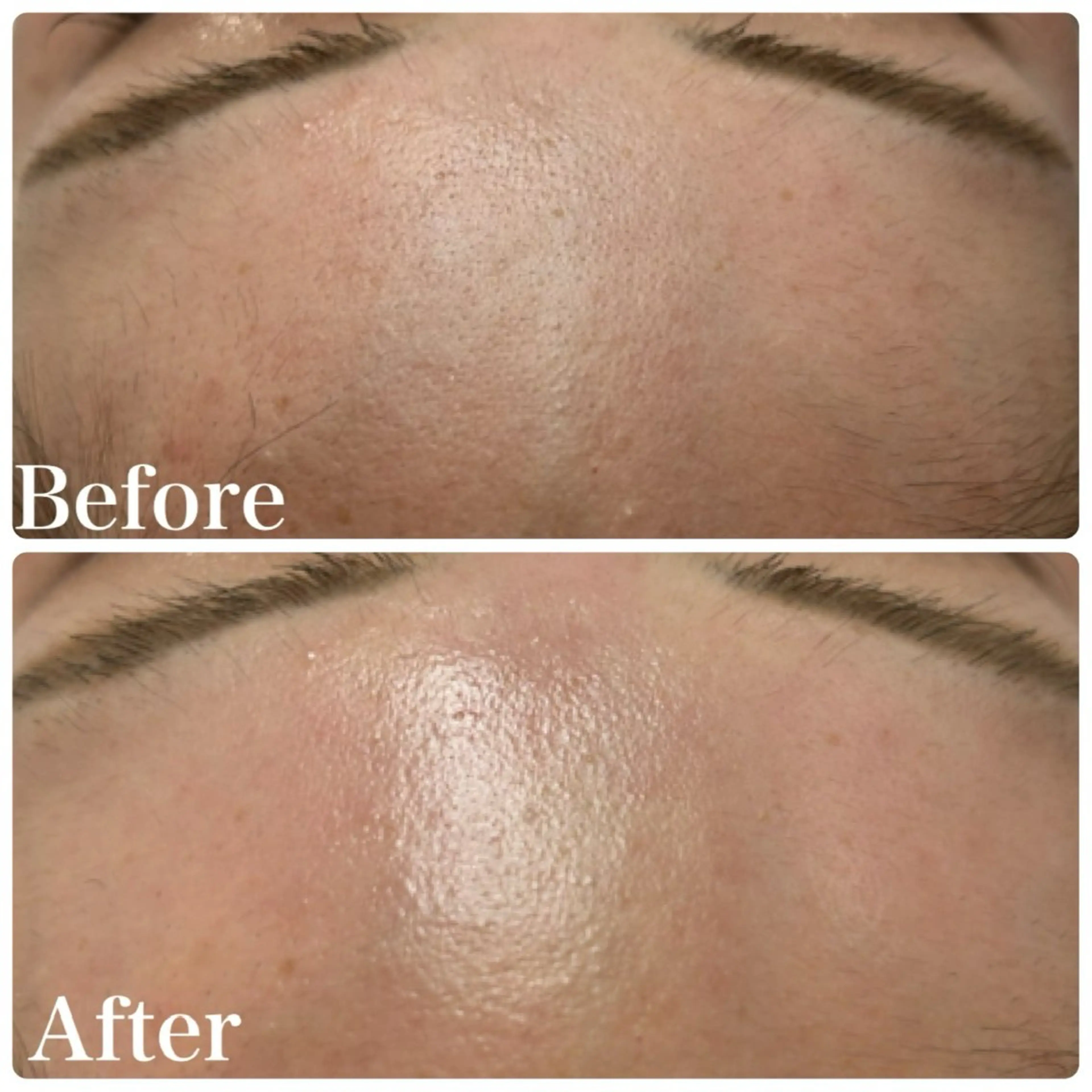 脱毛 LAKI eye&face  studio所属・LAKI studioのエステ・リラクイメージ