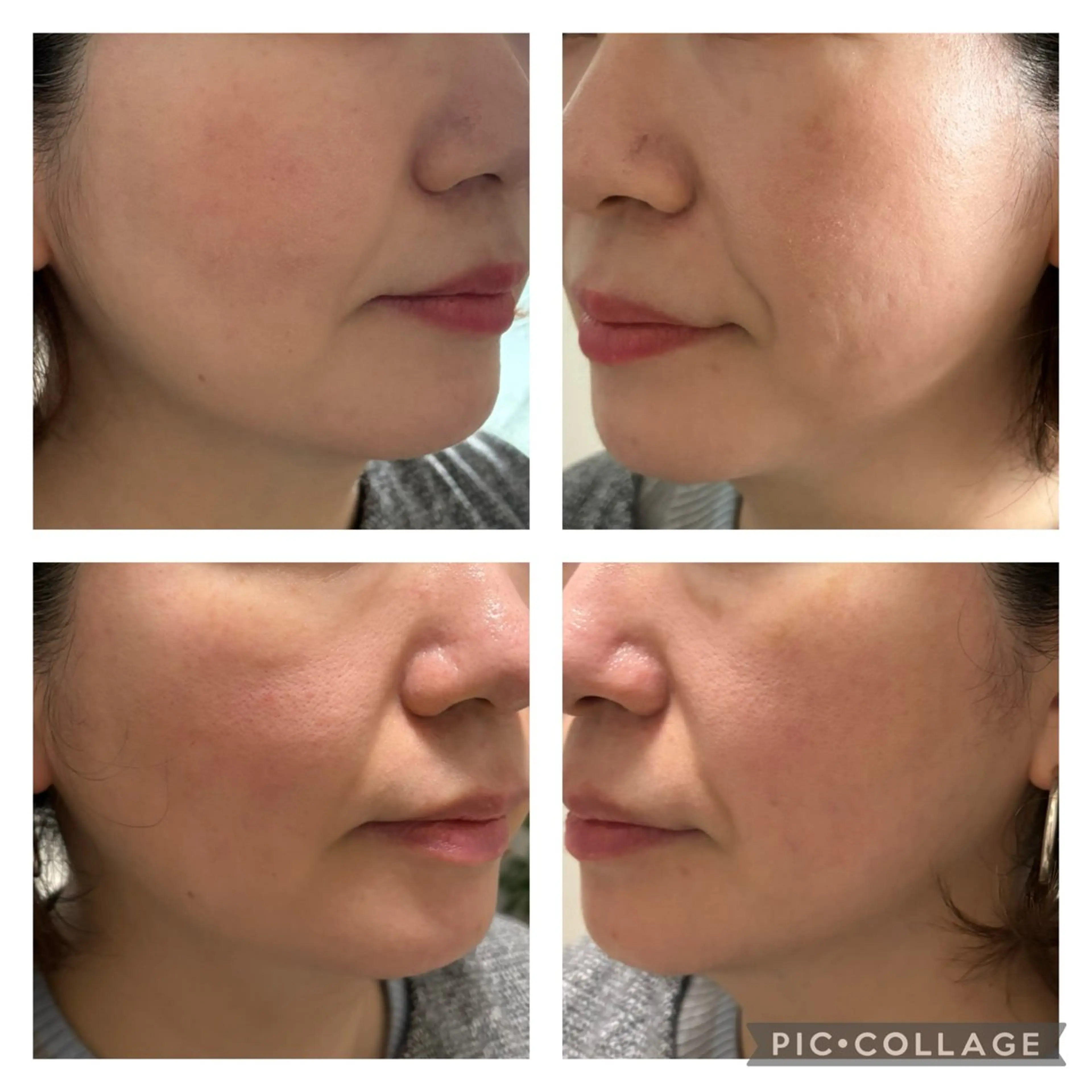 サロン LINOのエステ・リラクイメージ