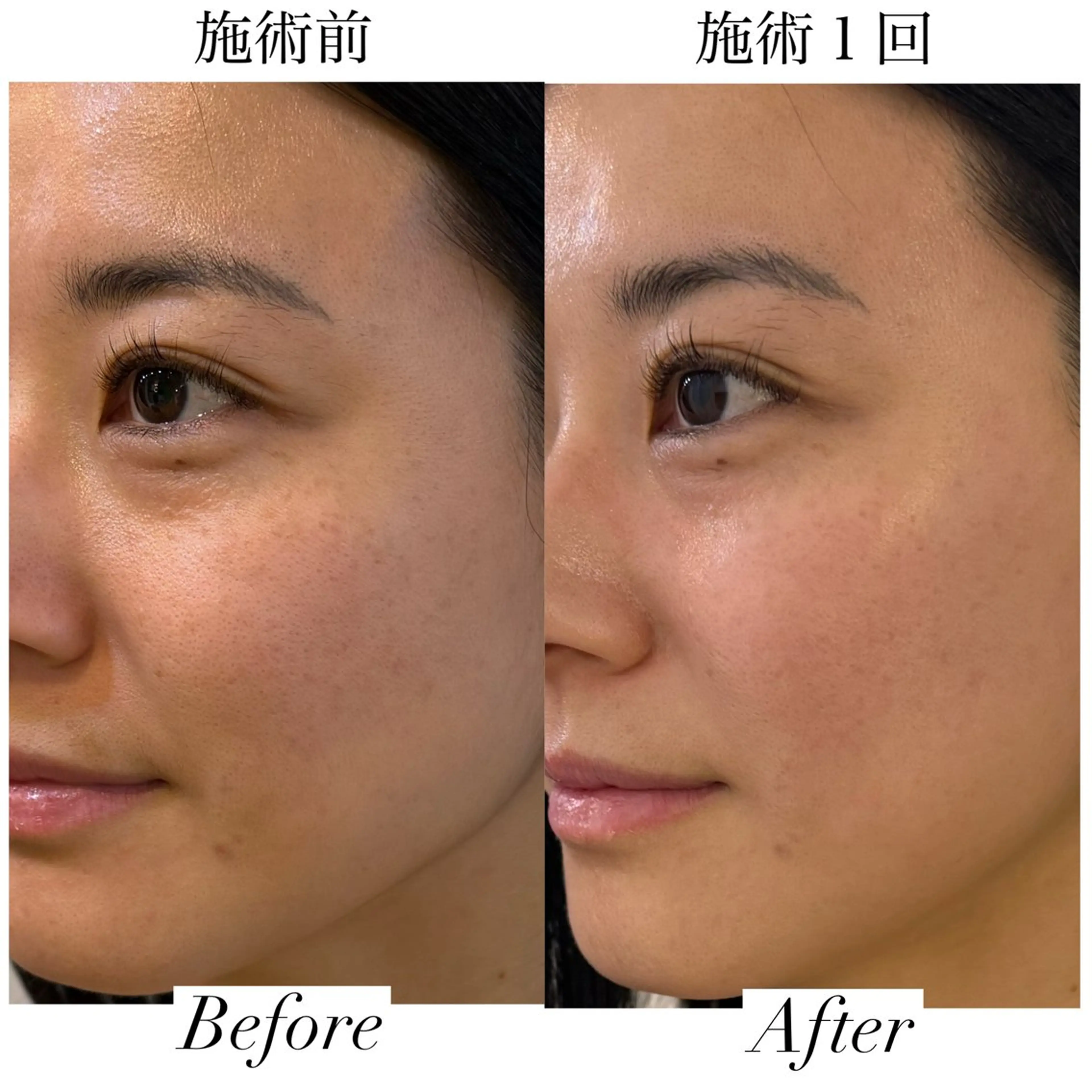 エステ リラク 【Salon D】 HALUのエステ・リラクイメージ