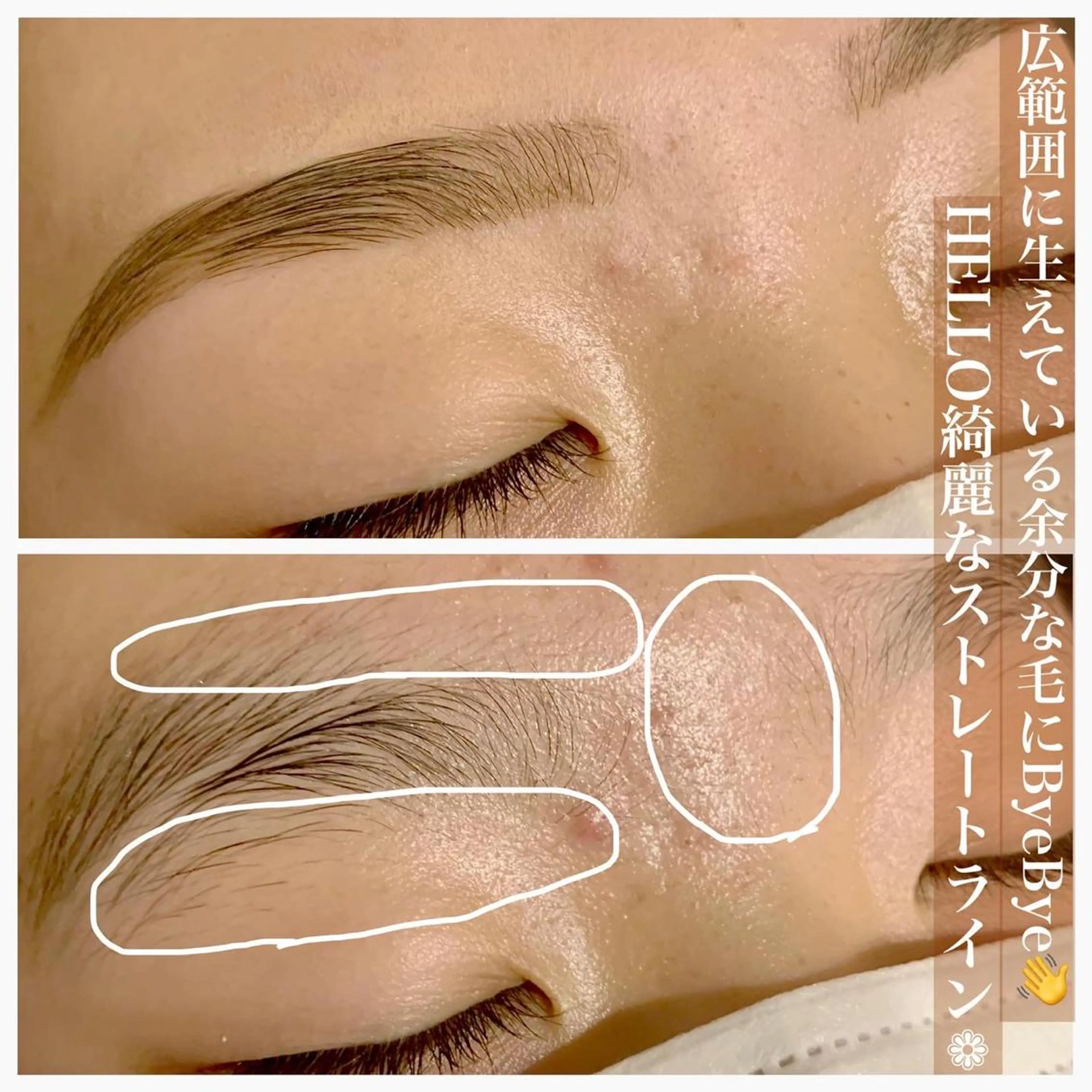 アイブロウ ハーブピーリング専門EMILUCA藤沢所属・ハーブピーリング /KAEDEのエステ・リラクイメージ