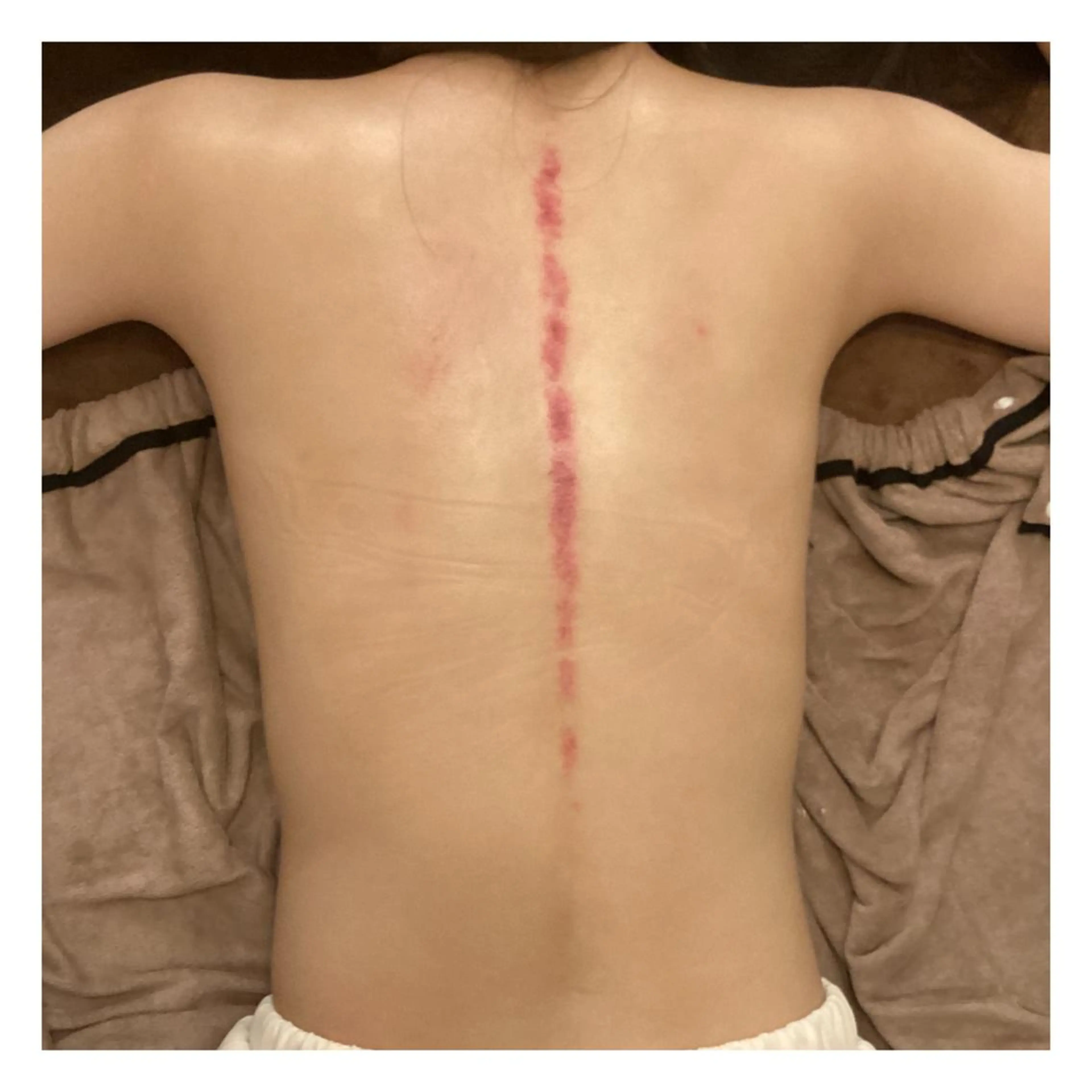 美腸専門 漢方よもぎ蒸しのエステ・リラクイメージ