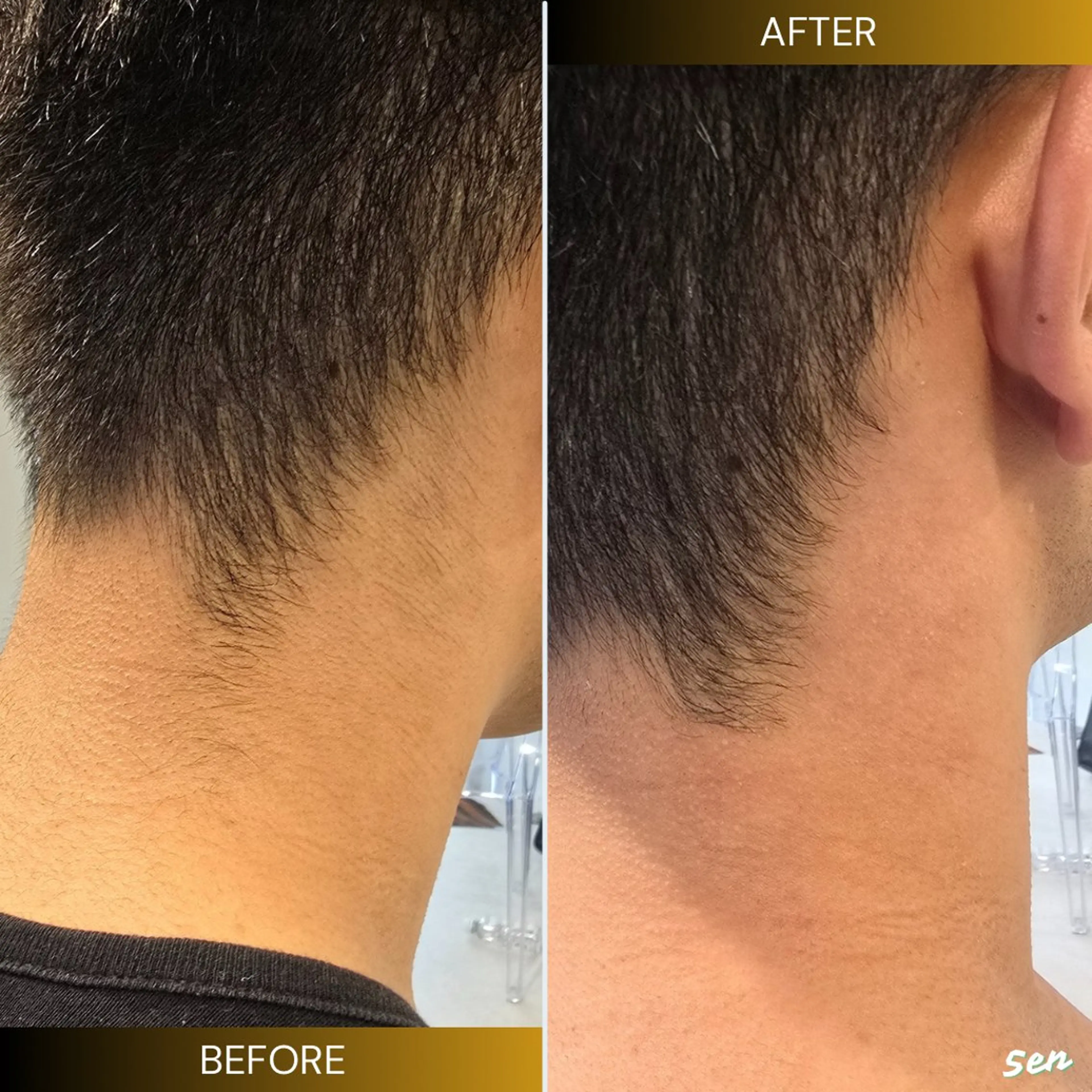 メンズ 脱毛 シュガーリング/脱毛 EARLS三軒茶屋のエステ・リラクイメージ