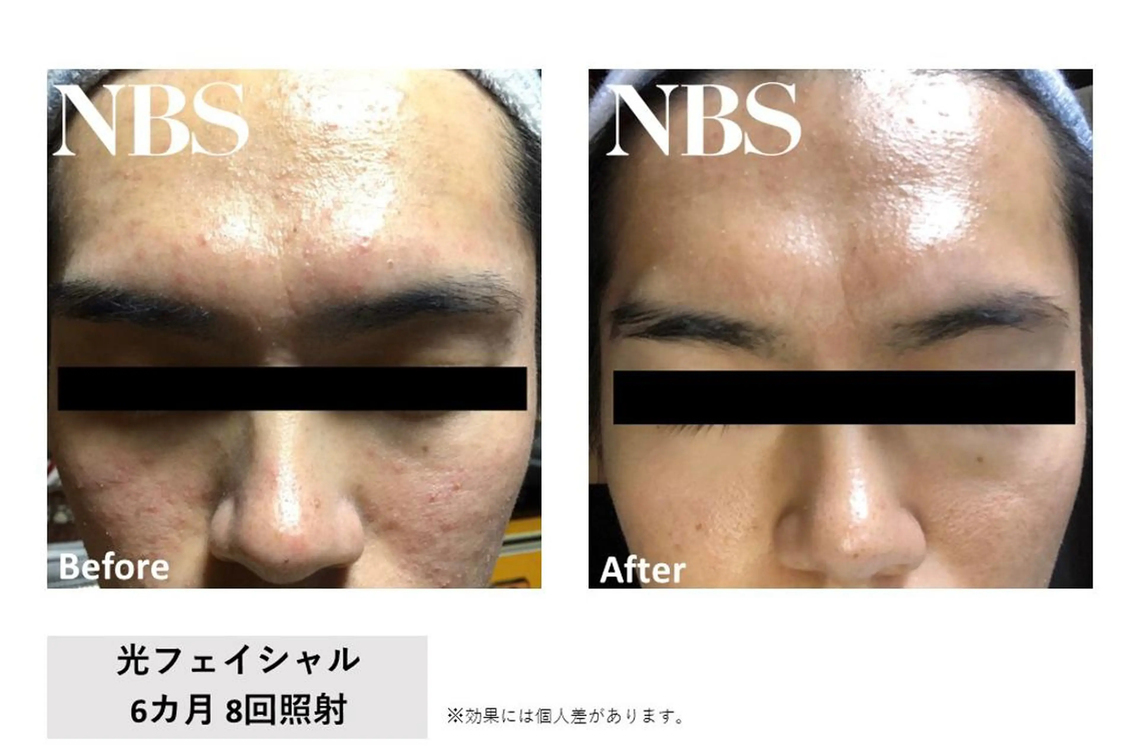 エステ 本八幡salon83 ♡エイトミーのエステ・リラクイメージ