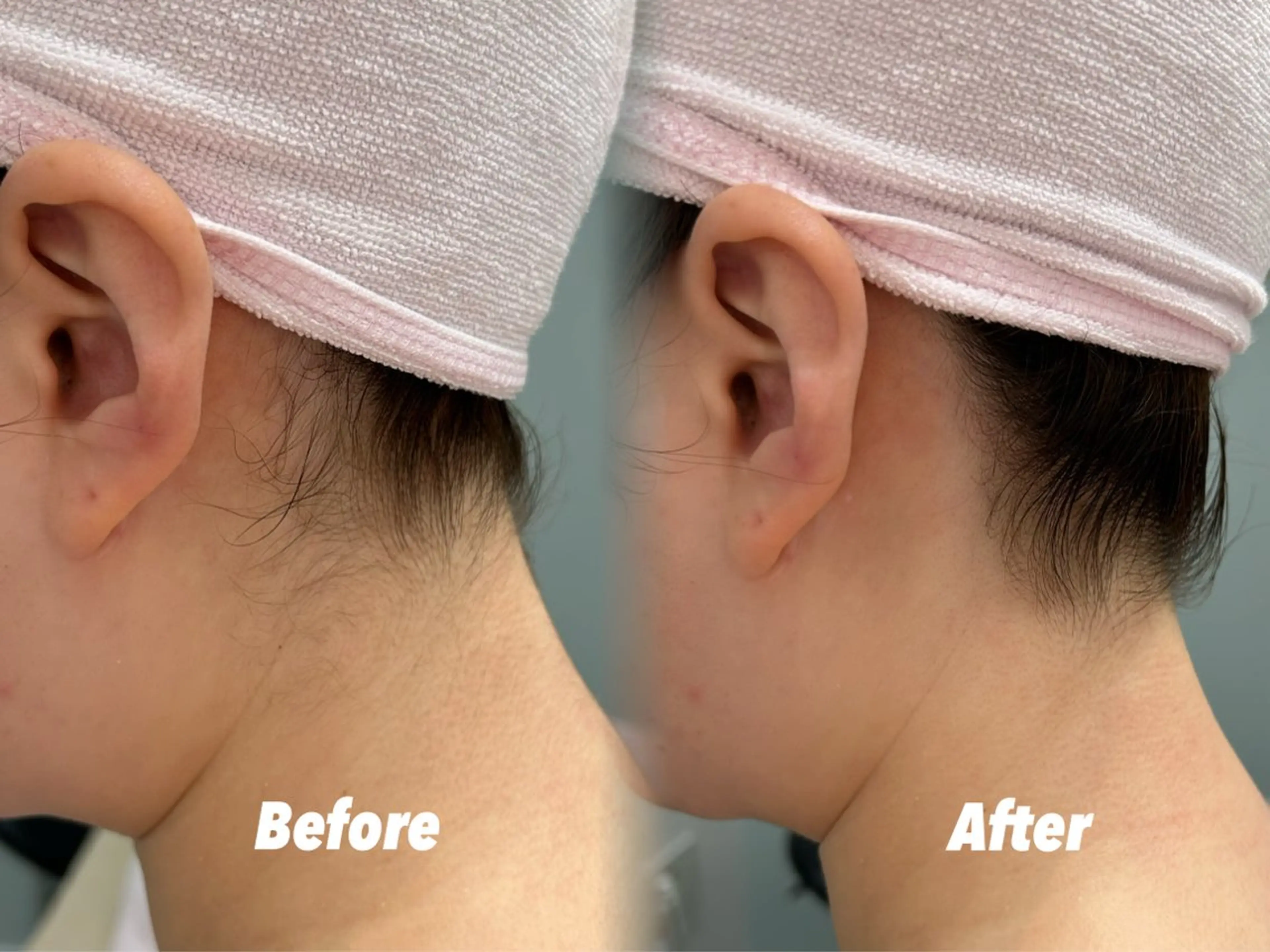 エステ 🫧美しい素肌へ🫧 今成柚乃のその他イメージ