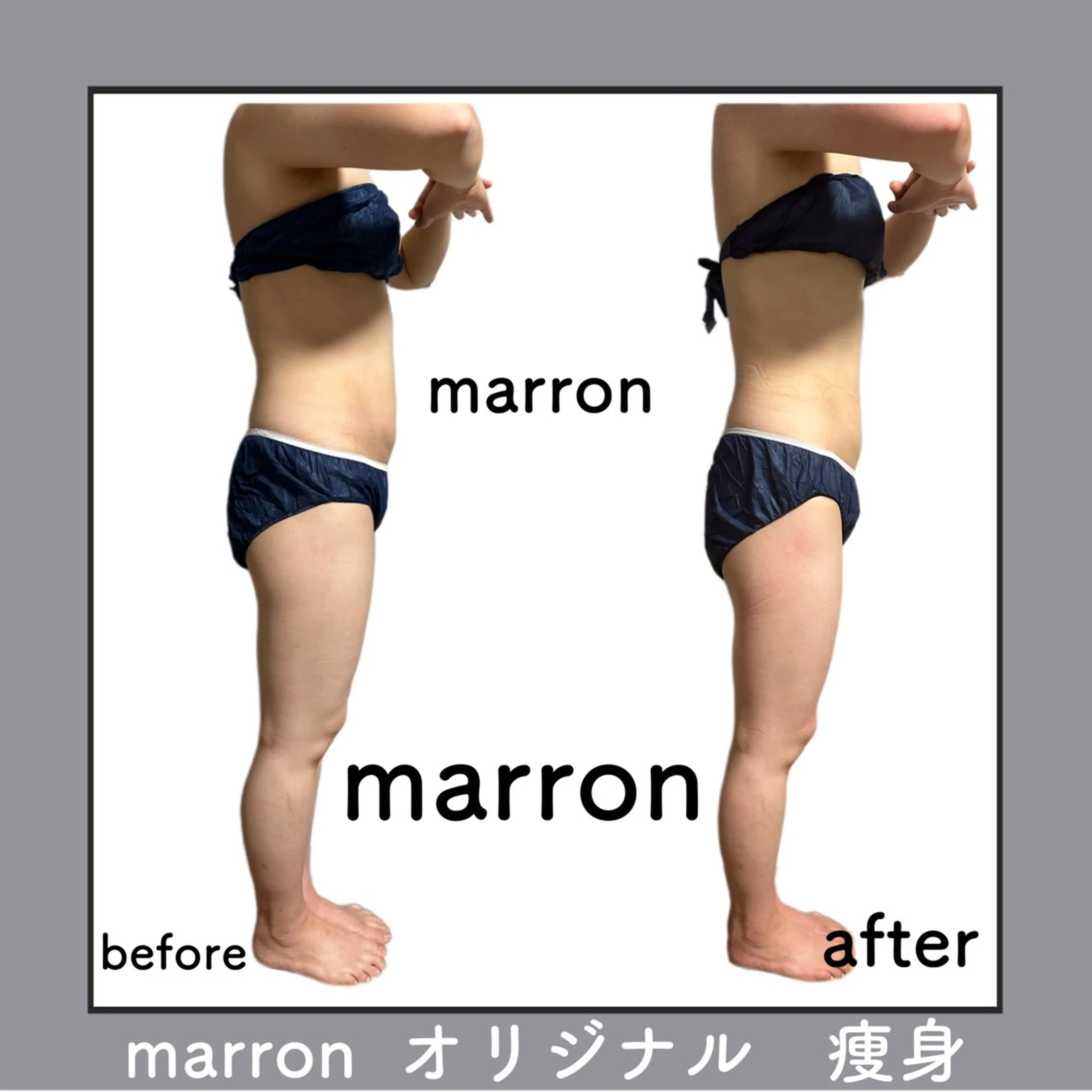 marron所属・痩身ハイパーナイフ ララピールリアボーテのエステ・リラクイメージ