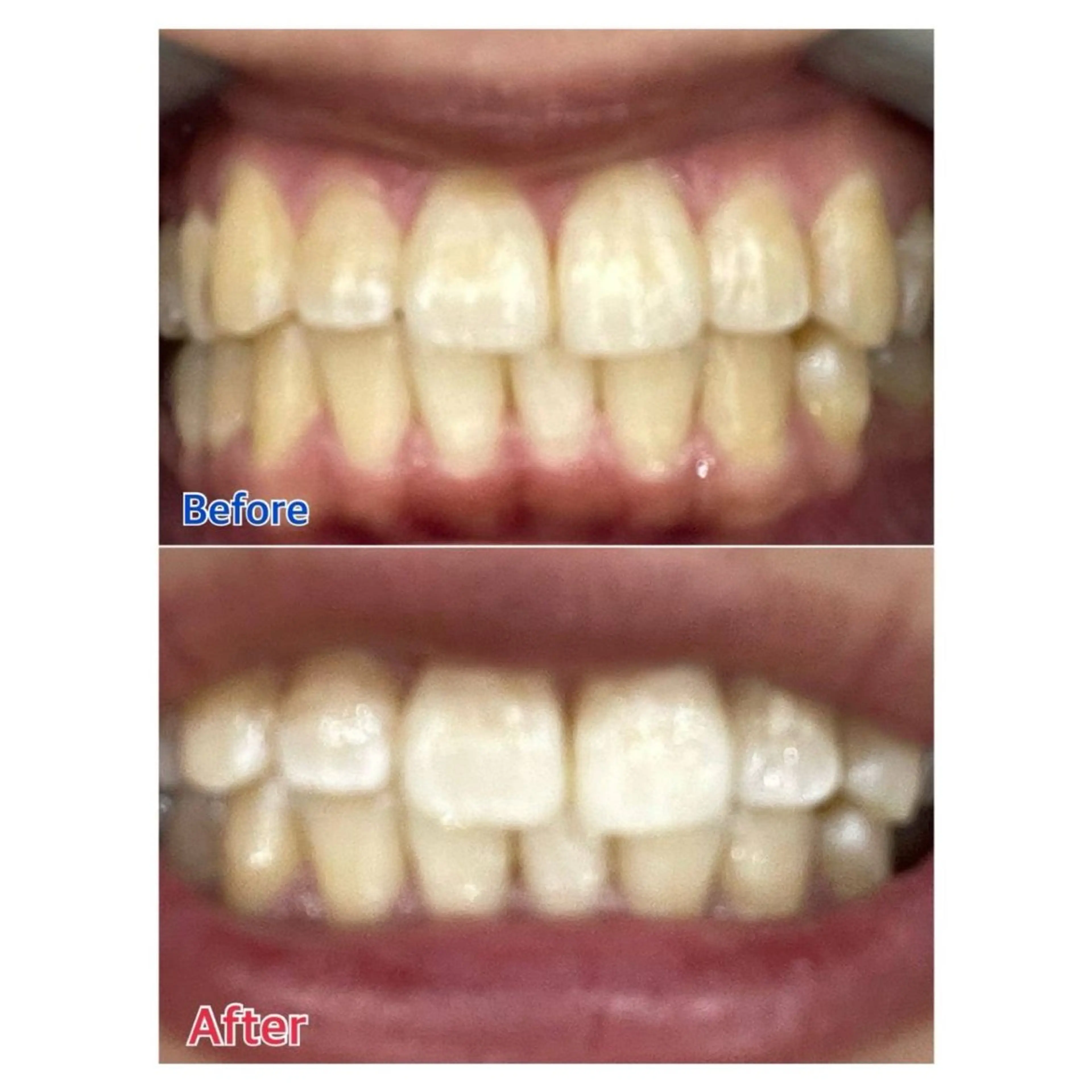 MBEAUTYSALON 千葉店・京成大久保所属・Melty 輝のその他イメージ