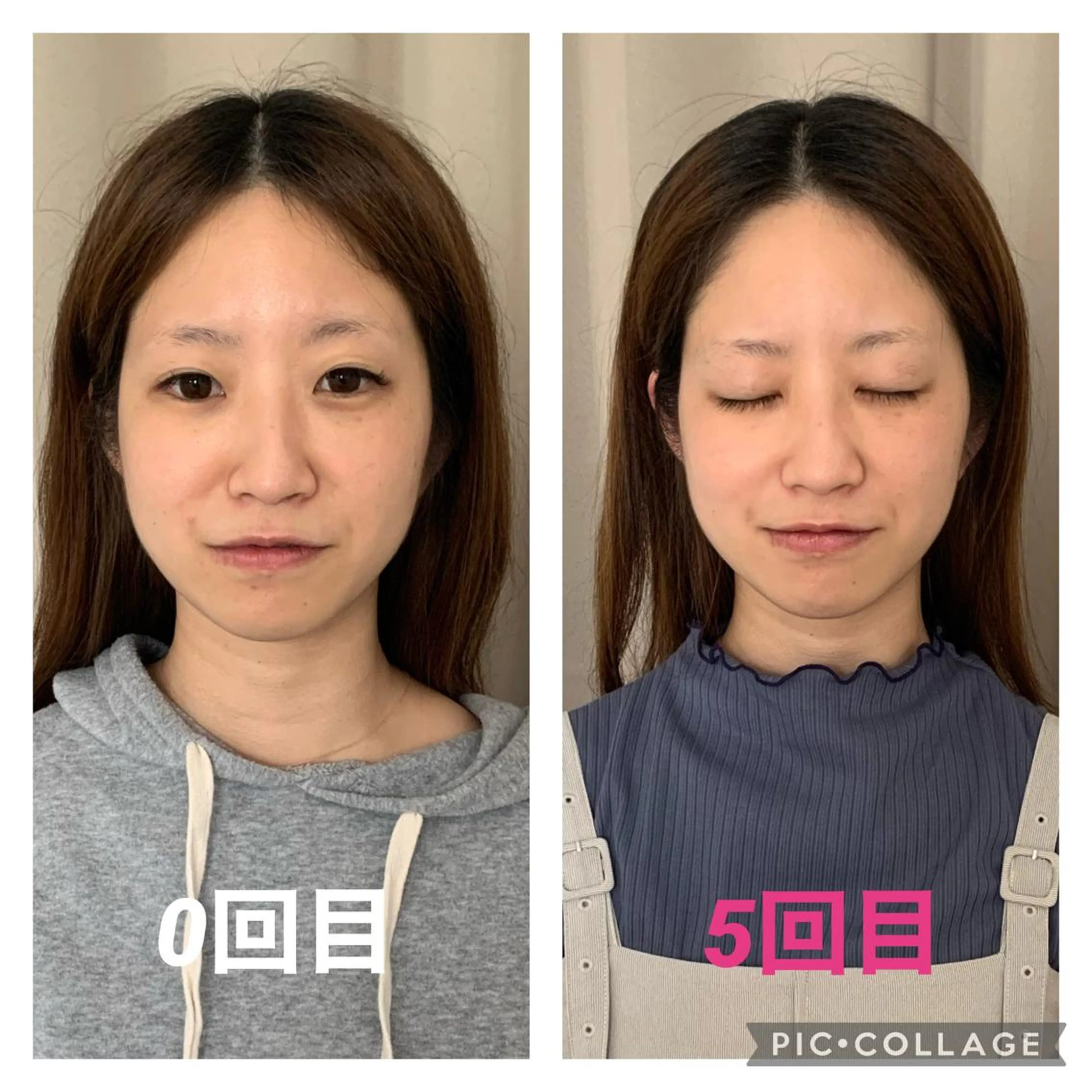 インタークロス所属・小顔矯正専門TIAM インタークロス池袋店のエステ・リラクイメージ