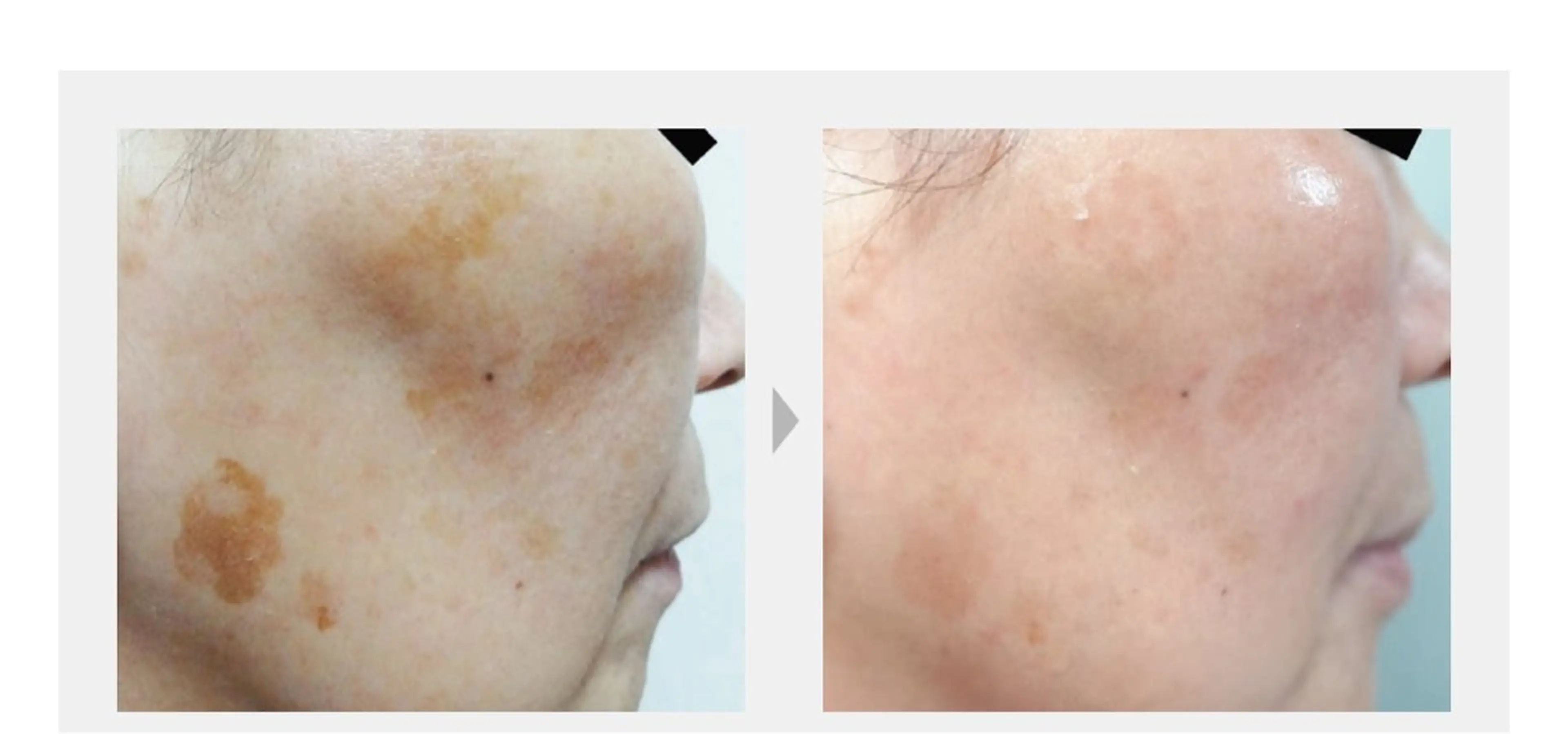 M. lisyelのエステ・リラクイメージ