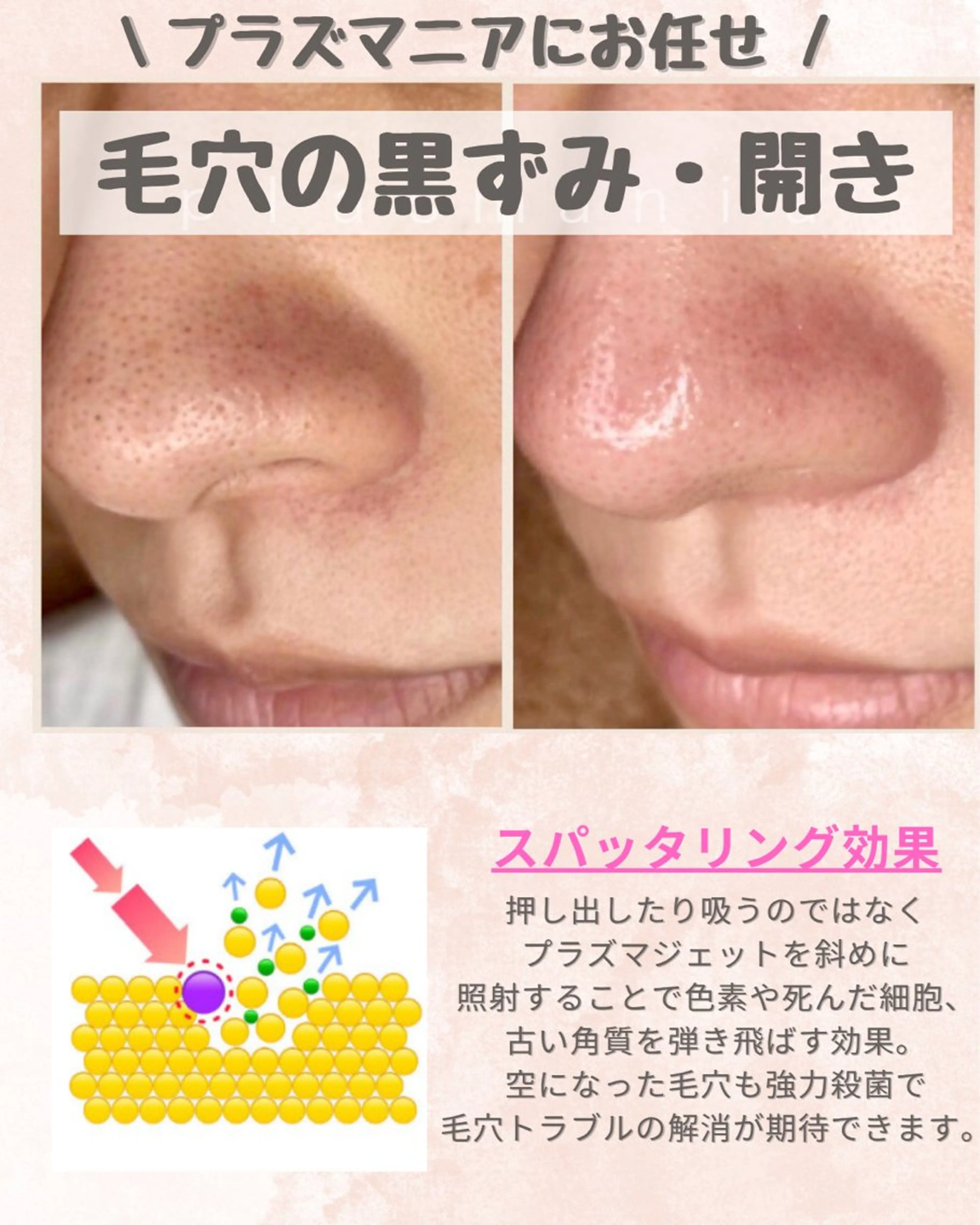 痩身・フェイシャル/if byOrabriller所属・if byOrab riller【イフ】のその他イメージ