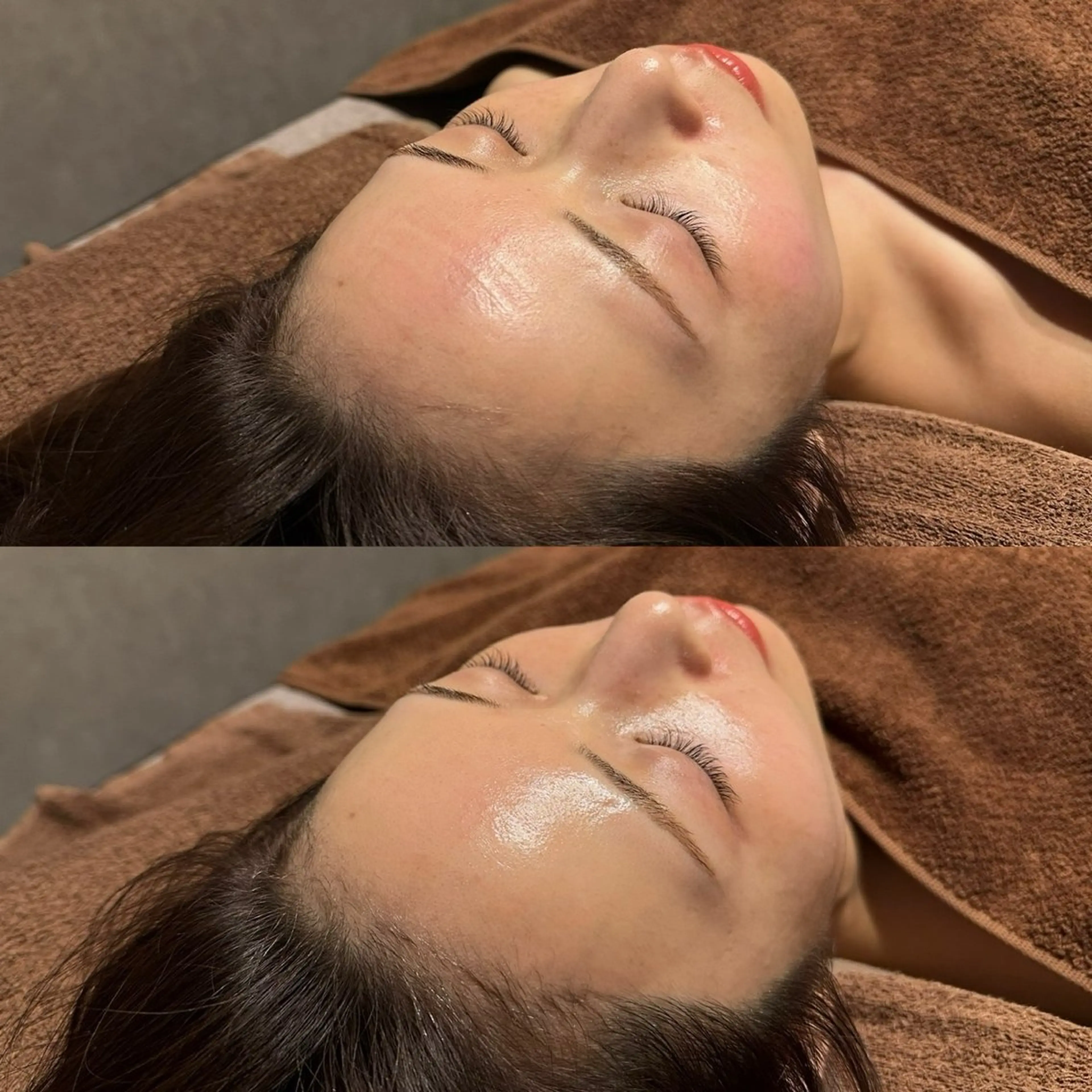 【期間限定】ミコステラ¥8,800の写真