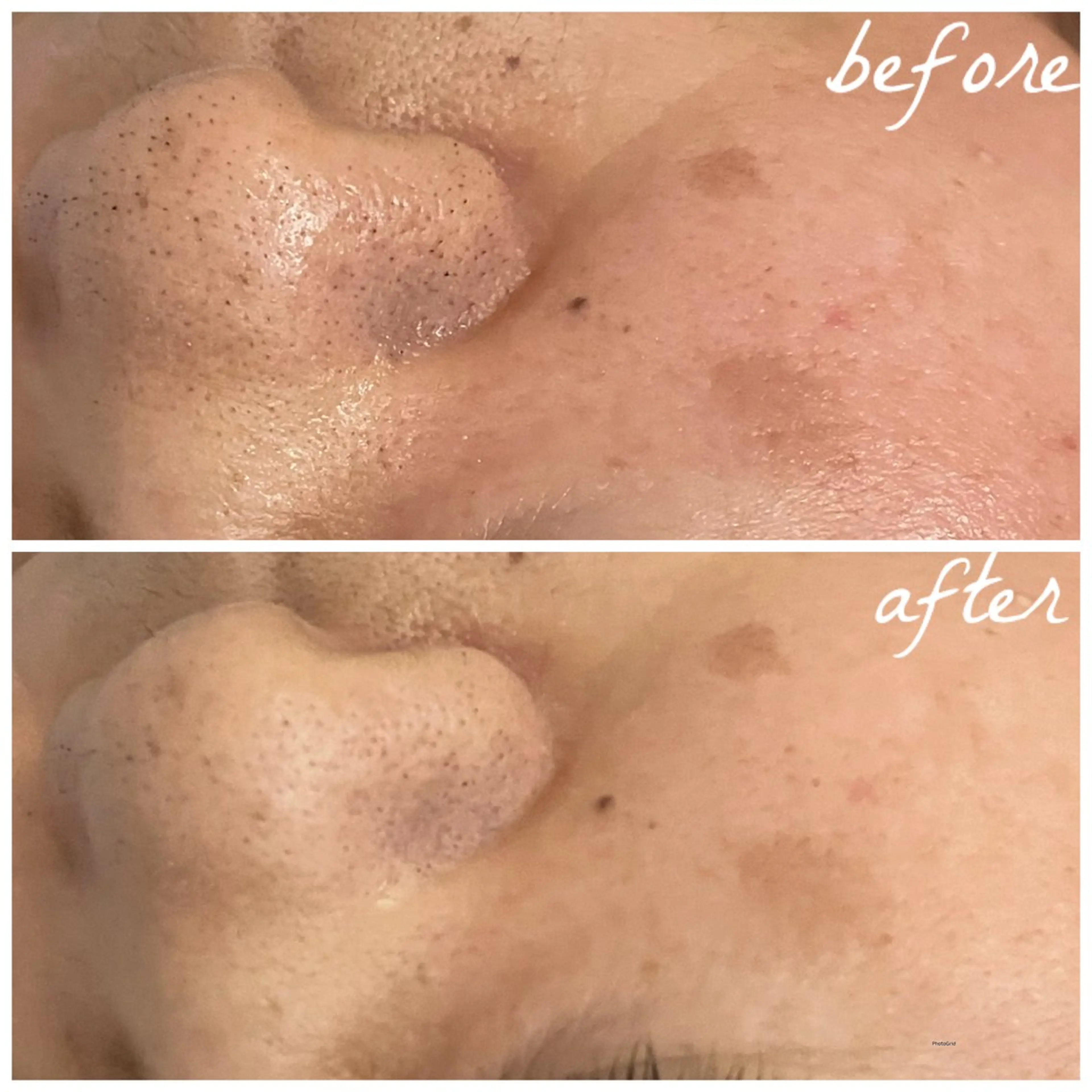 メンズ メナード岐阜茜部 杉浦のエステ・リラクイメージ